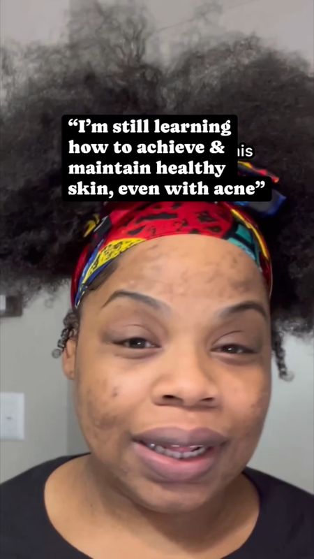 Hey beautiful! 🥰👋🏾 I'm Jess, a 33 year old with oily skin, on a mission to balance my skin health while tackling hormonal acne and hyperpigmentation💫 

For years, I chased ‘glass’ skin, battling acne with harsh products and picking at imperfections. But recently, I’ve had a change of heart🫶🏽

Perfect skin isn’t the goal anymore. I’m embracing healthy skin, flaws and all

Our skin reflects our overall health, so I’m focusing on creating intentional routines, nourishing my body and building healthy habits💪🏾

No more harsh treatments or self-criticism—just a journey towards radiant, healthy skin!

So follow along with me on this journey as we swap skincare tips, routines, and reviews to achieve that glowing, healthy skin we all desire! ✨ 

Let’s glow together, shall we? 🤞🏽 

#SkincareJourney #HealthySkin 
#acnepositivity #acnescars #acneskincare #acnetips #acnecommunity #acneproneskin #acnejourney #skininfluencer #realskincare #realskintexture #skincareroutine #skincare101 #skincaretips #skincareforbeginners #ipreview 

#LTKbeauty #LTKVideo