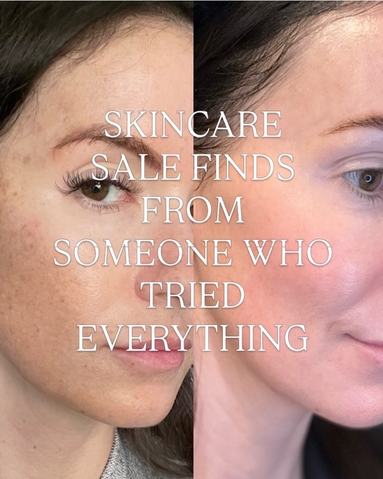 Amazon Big Spring Sale skin care finds! 

#LTKBaby #LTKSaleAlert #LTKOver40