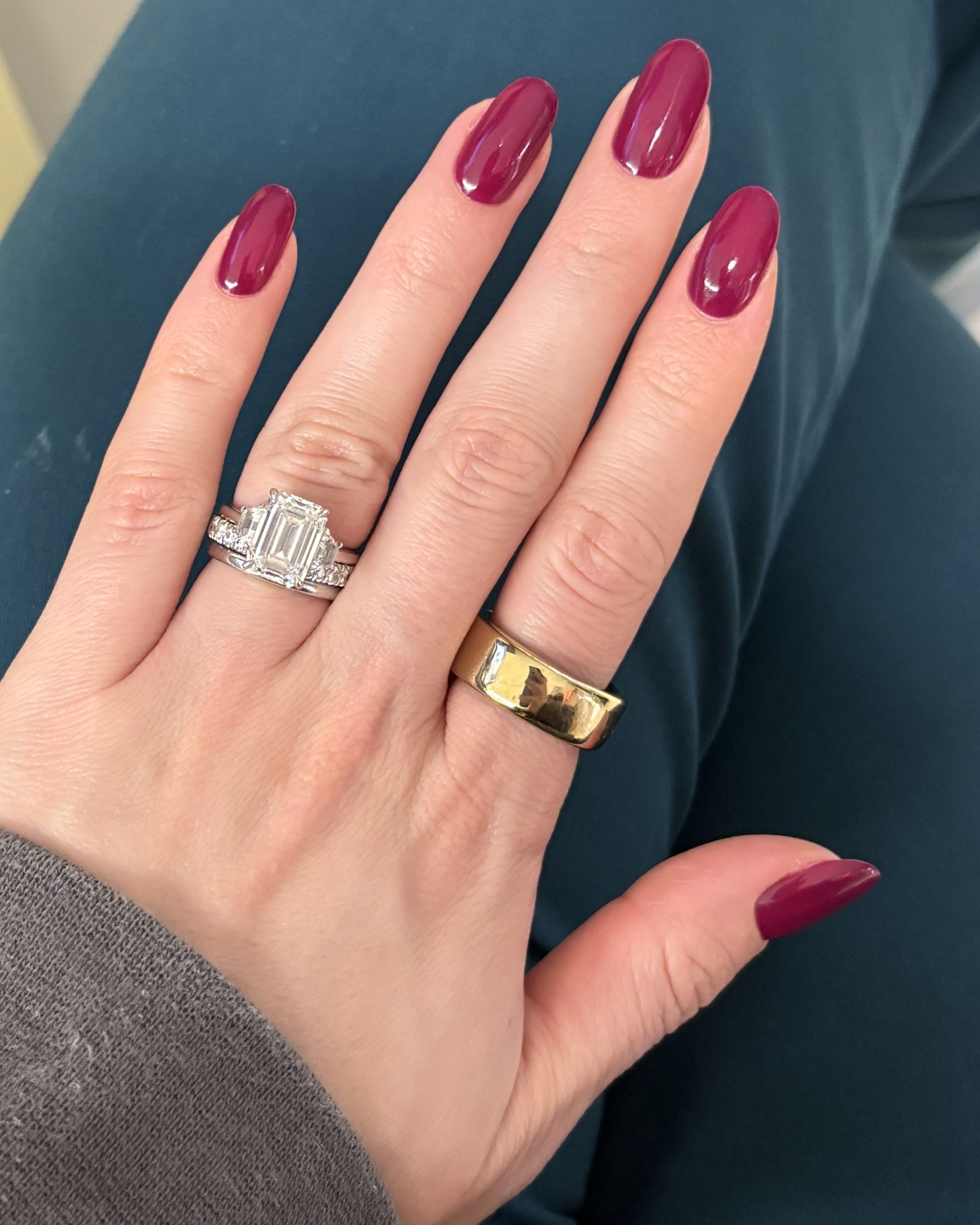 Best thing I did for my health was buy an Oura ring!! Zero regrets 

#LTKfitnessgoals #LTKdayinmylife #LTKActive