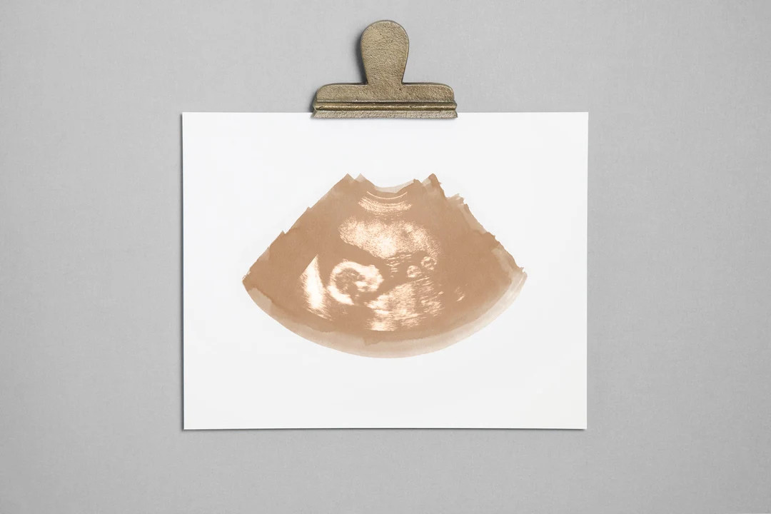 SAND Ultrasound Sonogram Physical Print - Etsy Canada | Etsy (CAD)