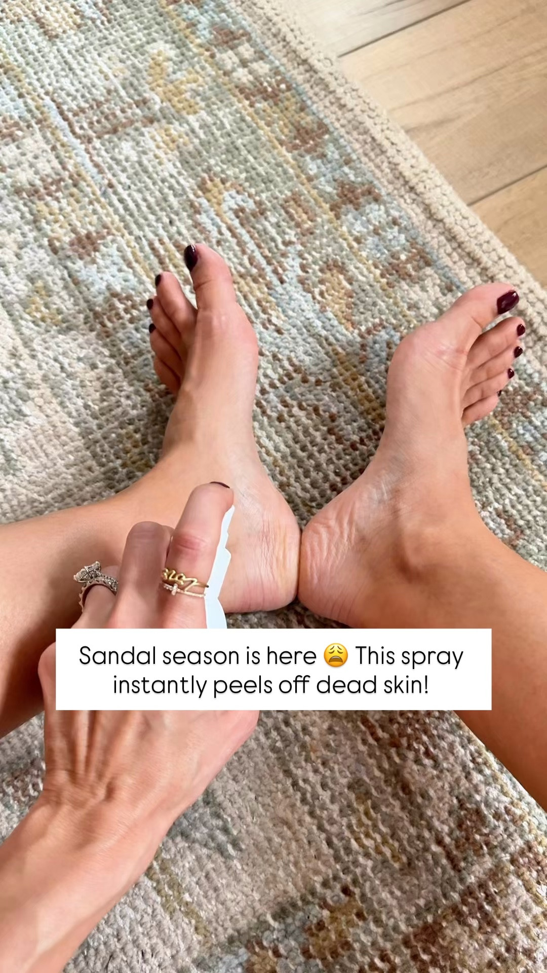 Unsexy and anti aging hacks I’m never giving up! Foot peeling spray and stick to keep feet smooth. Summer essentials. 

#LTKselfcare #LTKmorningroutine #LTKBeauty