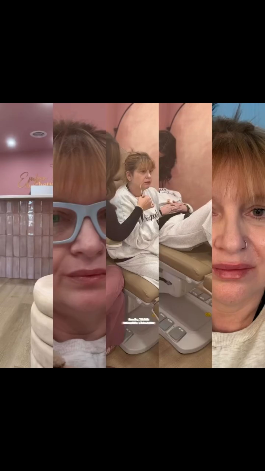 @emberaesthetics_ @injector.karinn 

Since I am almost 53, I decided to opt for some dermal filler intervention.  I take really good care of my skin, but age, genetics, and of course, gravity has taken its toll.  I researched my options and decided to forgo Botox and opt for dermal filler instead.  Botox is a neurotoxin which freezes the muscles where dermal filler contain hyaluronic acid which adds volume.  Plus, dermal filler lasts hella lot longer.  Initially, dermal fillers are more pricey than Botox, But in the long run you don’t need as many applications or touch ups. We’re talking basically once  a year versus Botox’s every 3-4 months.

Karinn is super funny, sweet, & knowledgeable.  If you’re on the fence about getting dermal filler, this is your sign to just do it.  You deserve it and if you’re in central Pa, I highly recommend Ember Aesthetics. 

Thanks Karinn!  You really put me at ease and I enjoyed my appointment! 

#fightingmothernature #emberaesthetics #dermalfıllers #injectable #over50woman

#LTKvlog #LTKOver40 #LTKselfcare