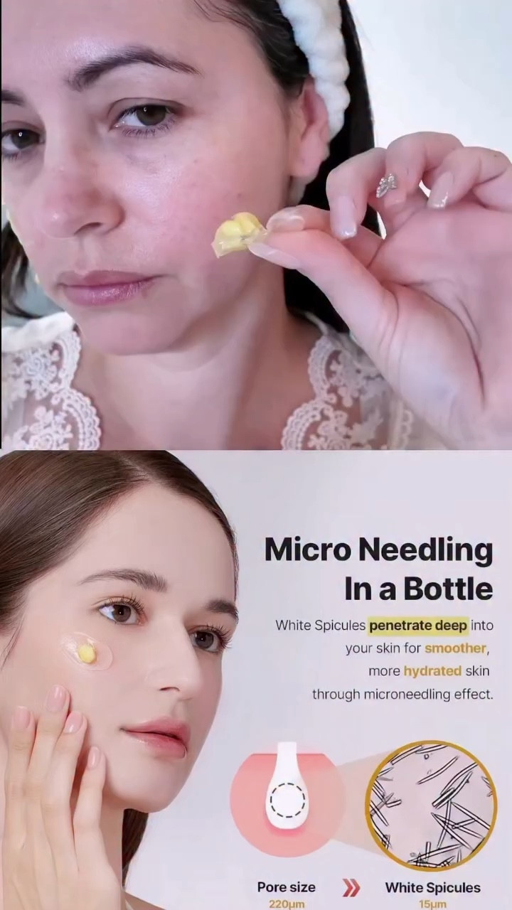 Tratamiento de Microagujas en Casa: El Dúo Koreano Revolucionario sin Agujas
. 
Comenta “dúo” para que recibas el enlace ✅
.
#kbeauty #Microagujas #Retinol #koreanfacial #BellezaEnCasa