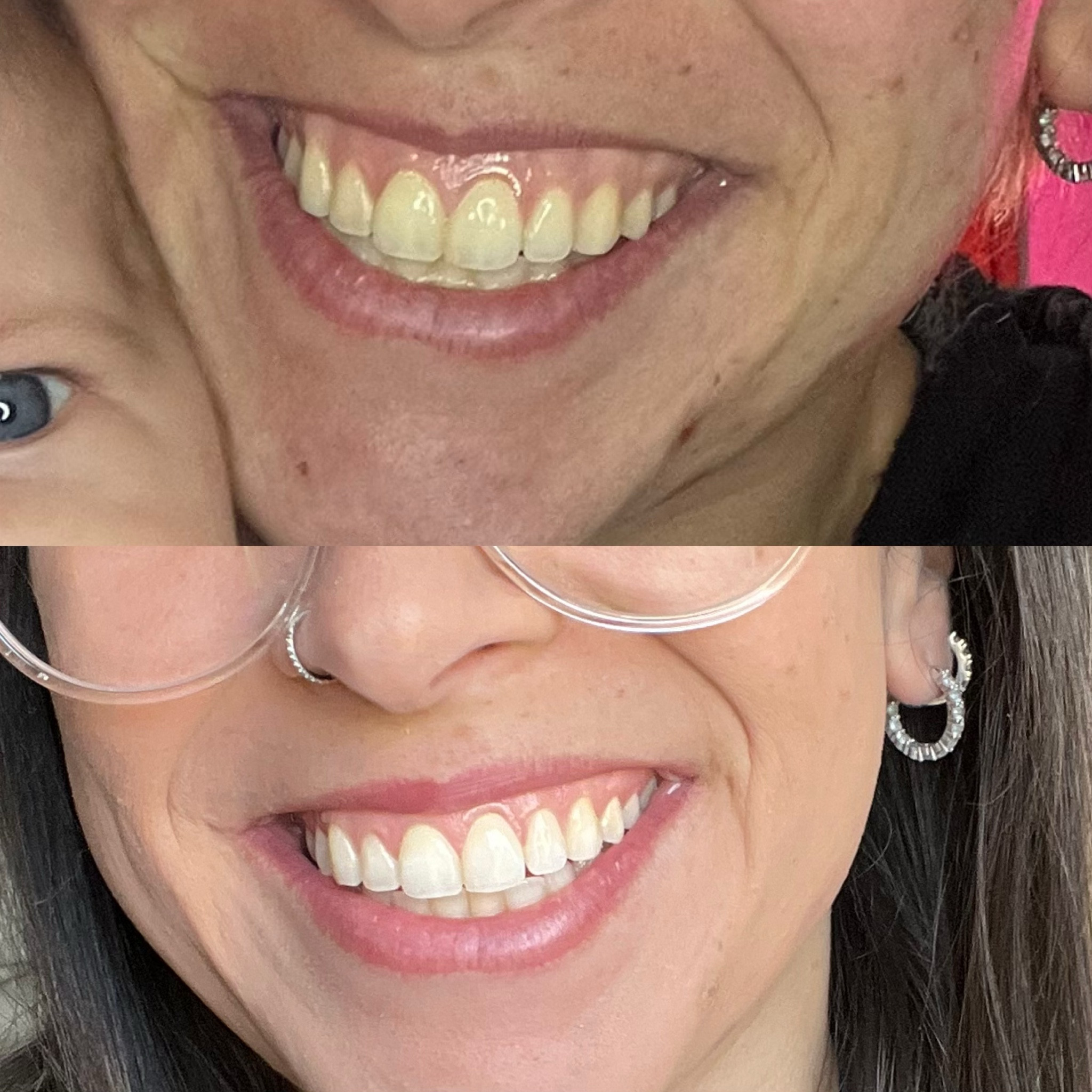 This is only 2 treatments of my new fav whitening kit that is ONLY $10!!!!! You can also drink water AND they stick so good to your teeth so they don’t move around like normal whitening strips!!! + perfect for sensitive teeth! Run, run run!!! 

#LTKfindsunder50 #LTKGiftGuide