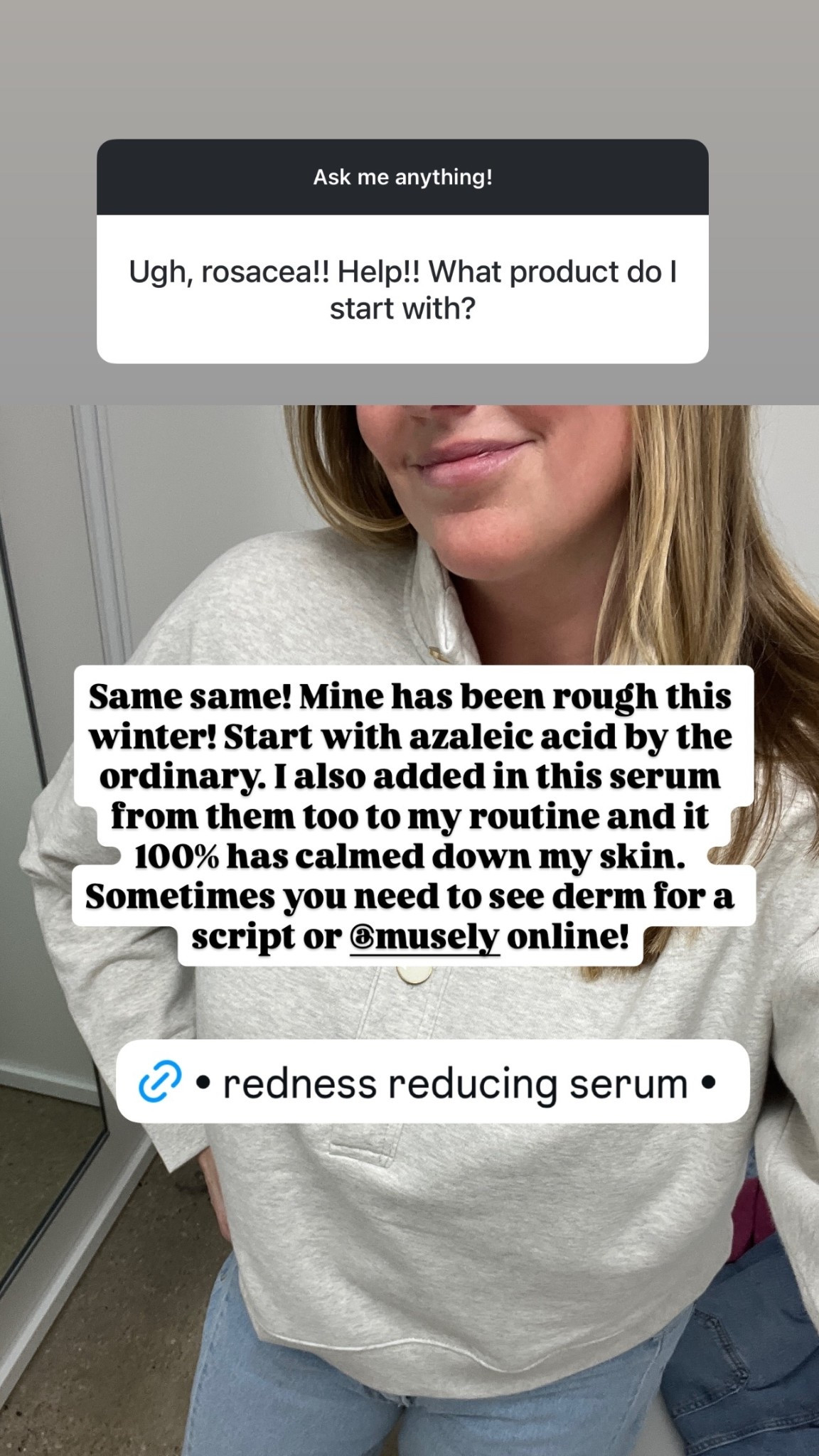 Same same! Mine has been rough this winter! Start with azaleic acid by the ordinary. I also added in this serum from them too to my routine and it 100% has calmed down my skin. Sometimes you need to see derm for a script or @musely online!