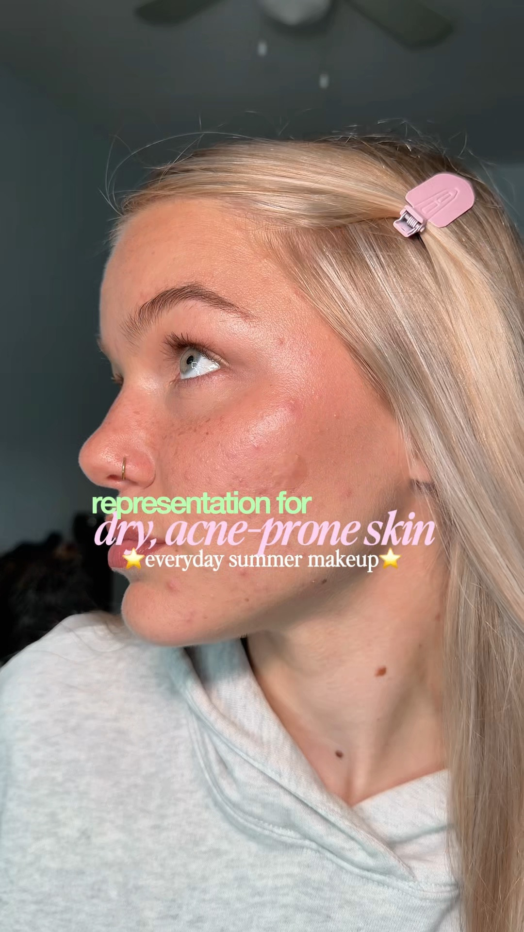 the ONLY makeup routine you need to look like a natural beauty with dry, acne-prone skin ⭐️

#LTKgrwm #LTKBeauty #LTKselfcare