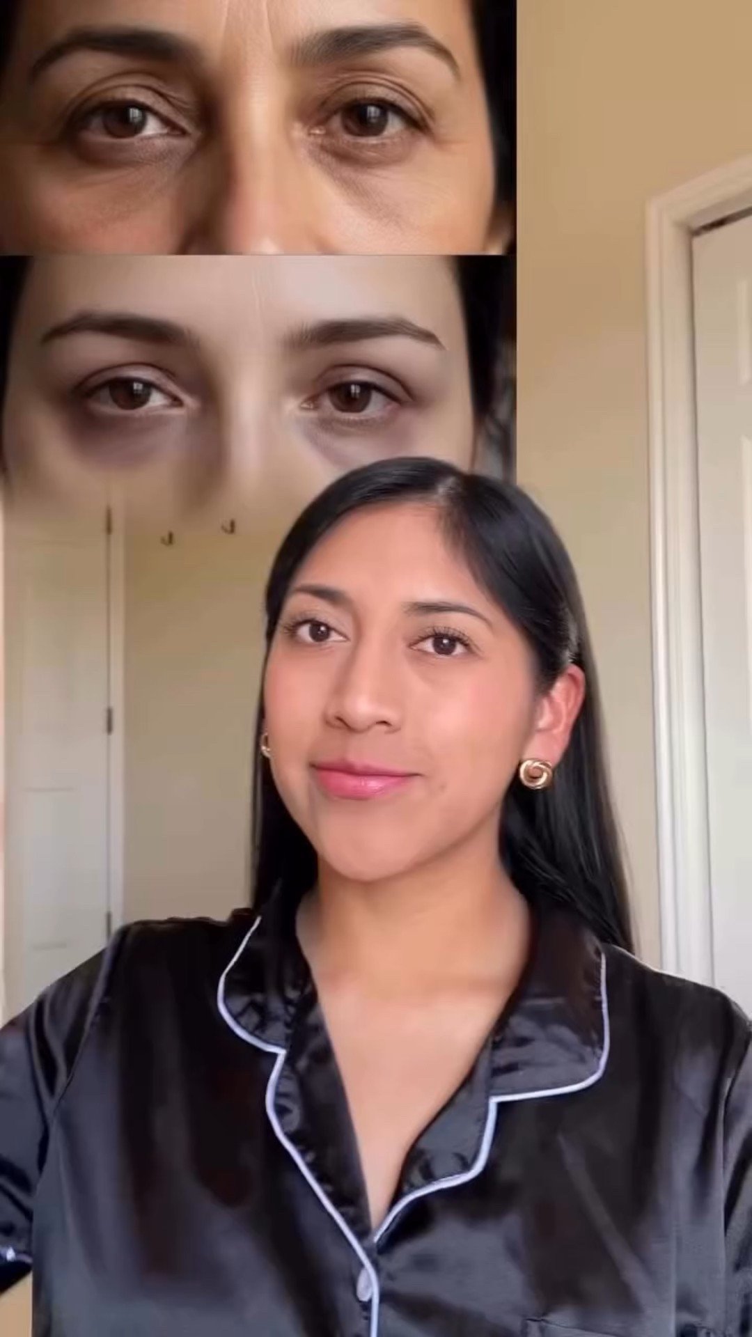 INIA LUMIN Eye Wand ayuda a reducir la hinchazón y las ojeras, dejando el área debajo de los ojos fresca, suave y radiante desde el primer uso 
Dale a tus ojos el glow up que se merecen! 
💆‍♀️ Masajea suavemente con Terapia de Luz Roja, Microcorriente EMS, Calor Térmico y vibraciones relajantes que te hacen sentir como tener un spa en casa

Usando el código Jennifer__20 tienes $20 de descuento 

🎁 Perfecto para tu rutina de autocuidado o para regalar a alguien especial esta temporada 
Combínalo con tus parches para ojos favoritos y el rodillo para desinflamar 
 

#inia #inialumin