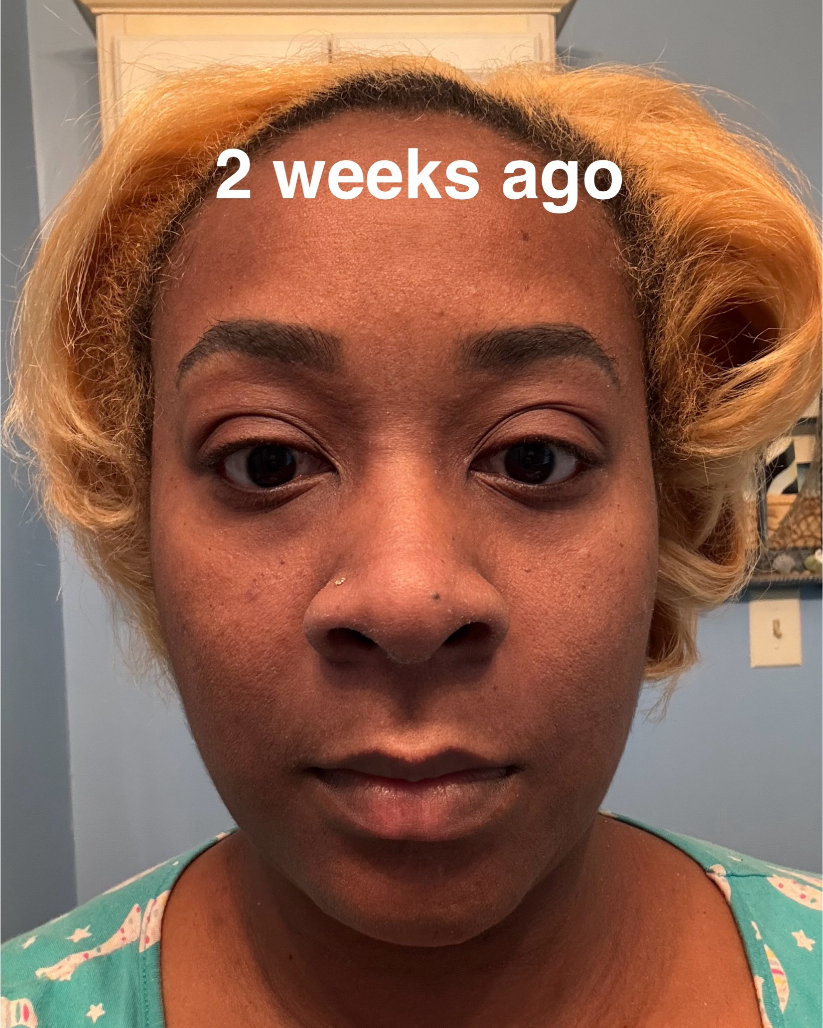 The winter months have been doing a number on my skin! Ive been experiencing extreme dryness. I’ve finally figured out a regimen for these cold months! Look at the difference in just 2 weeks of taking collagen 5 days a week, and using my wash, moisturizer daily. If you need a new skincare routine, try it. And don’t forget the Vitamin C Serum. That stuff is GOLD!! 

Products linked below! #skincare #hair #skin #health #middleage

#LTKmorningroutine #LTKBeauty #LTKselfcare
