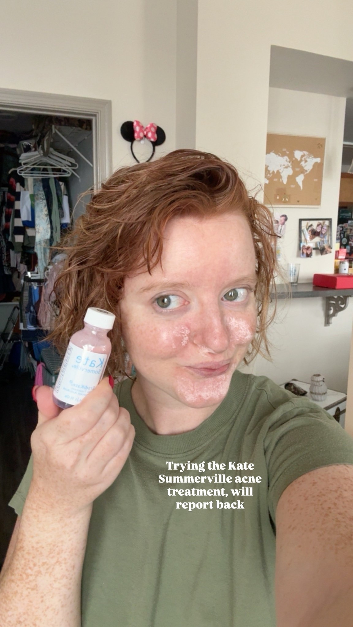 Trying out the Kate Somerville acne treatment! I have constant redness and skin issues and I’m hoping this is a great tool to clear up pimples before they become a problem 
Ulta, Sephora, skincare,

#LTKStyleTip #LTKFindsUnder50 #LTKBeauty