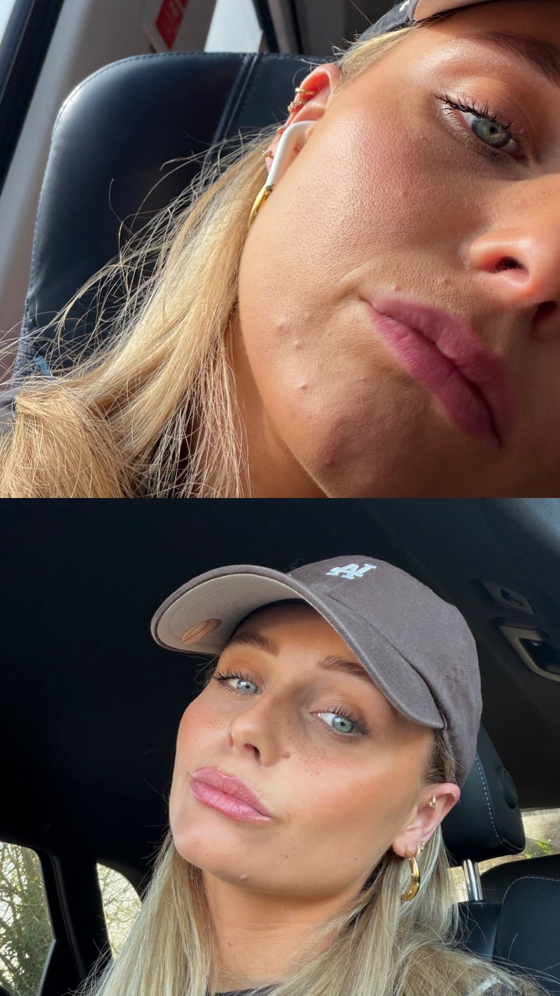 my recipe for clear skin! these pads are honestlty sooo good, they have completely cleared my skin! ad #amazon

#LTKspring #LTKbeauty