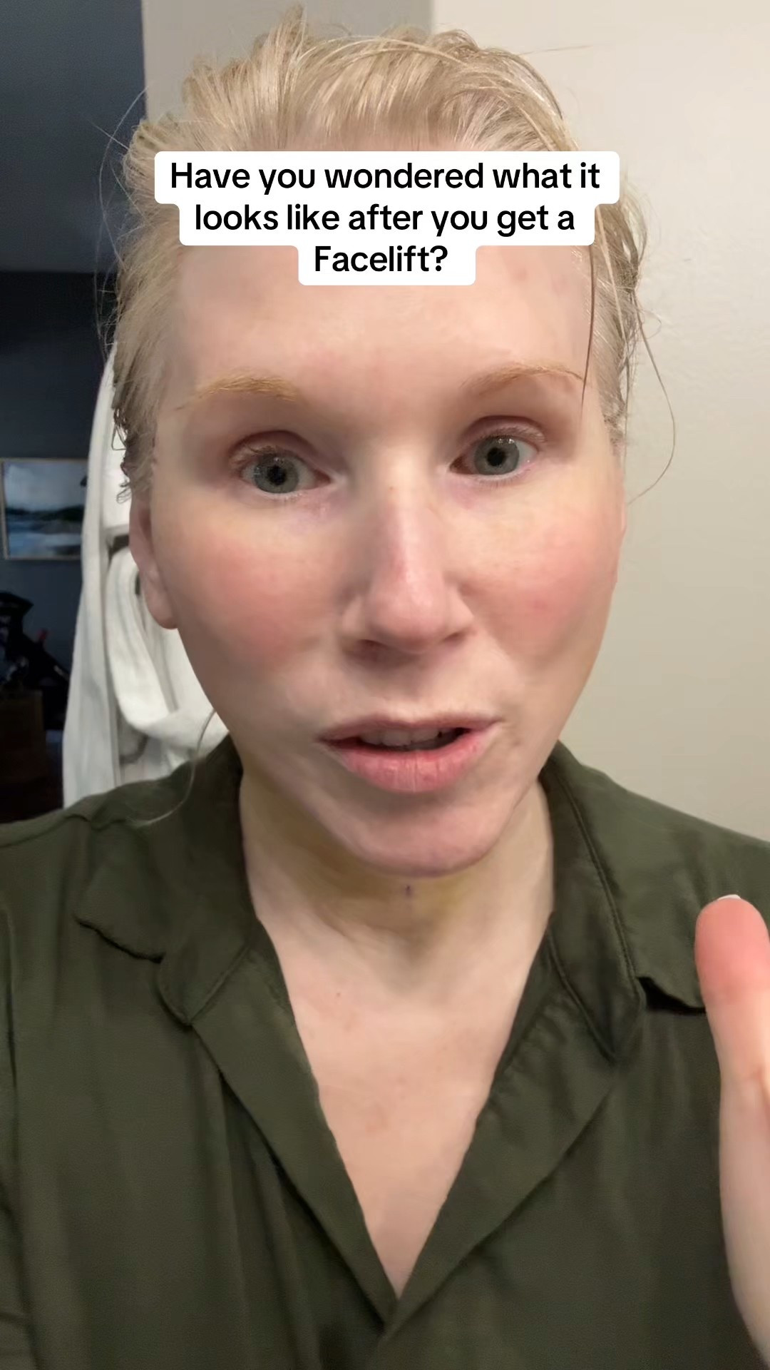 Day 5 after facelift!!  My first shower! 

#LTKOver40 #LTKBeauty