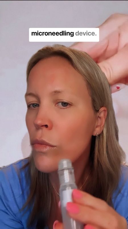 1 application of the anti-aging treatment that combines microneedling technique with a powerful, ultra-concentrated serum formulated with the most effective ingredients in the aesthetic field to rejuvenate your skin.
Proven clinical results visible from the first application:
● In 3h your wrinkles decrease by 18.9%*.
● In 24h your elasticity increases by 24.2%*.
● In 14 days, your firmness increases by 33.3%*.
5-minute ritual, once a month.
Easy, painless and safe to apply at home.
*Clinical results tested in independent laboratories.




#LTKVideo #LTKover40 #LTKbeauty