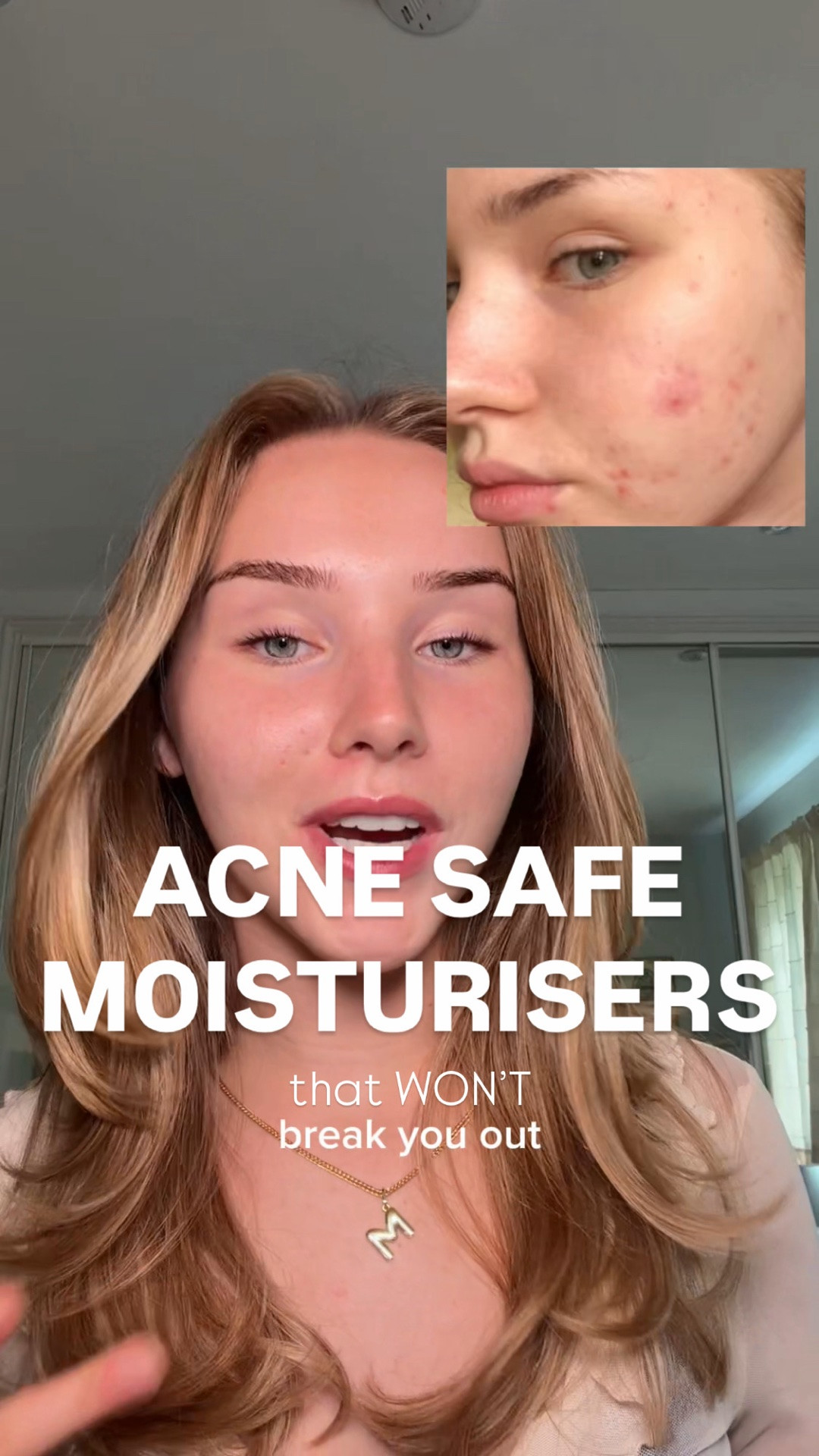 The best acne safe moisturisers!