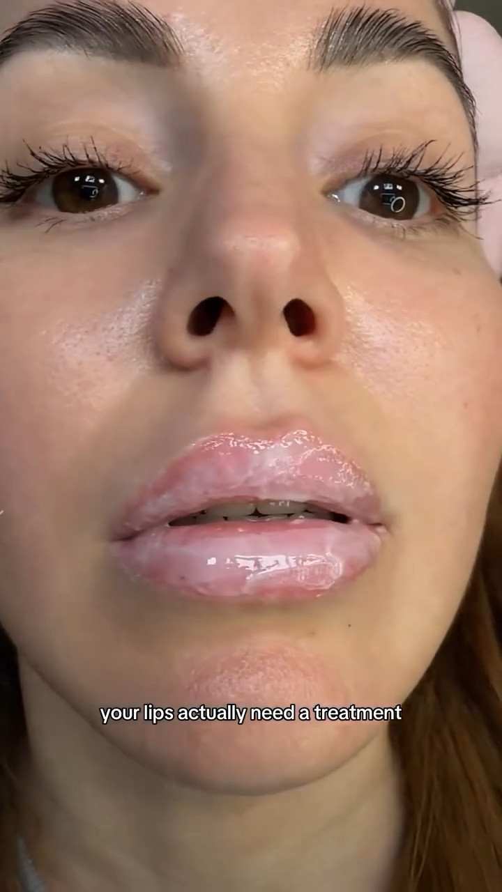 I thought lip balm was enough until a tried a REAL lip mask… the dodo is crazy 👄

#lipcare #lipmask #drylips #lakalipmask #hydratedlips

#LTKBeauty #LTKSpringSale #LTKselfcare