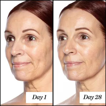 Sunday Riley Good Genes All-in-One Lactic Acid Exfoliating Face Treatment Serum | Nordstrom | Nordstrom