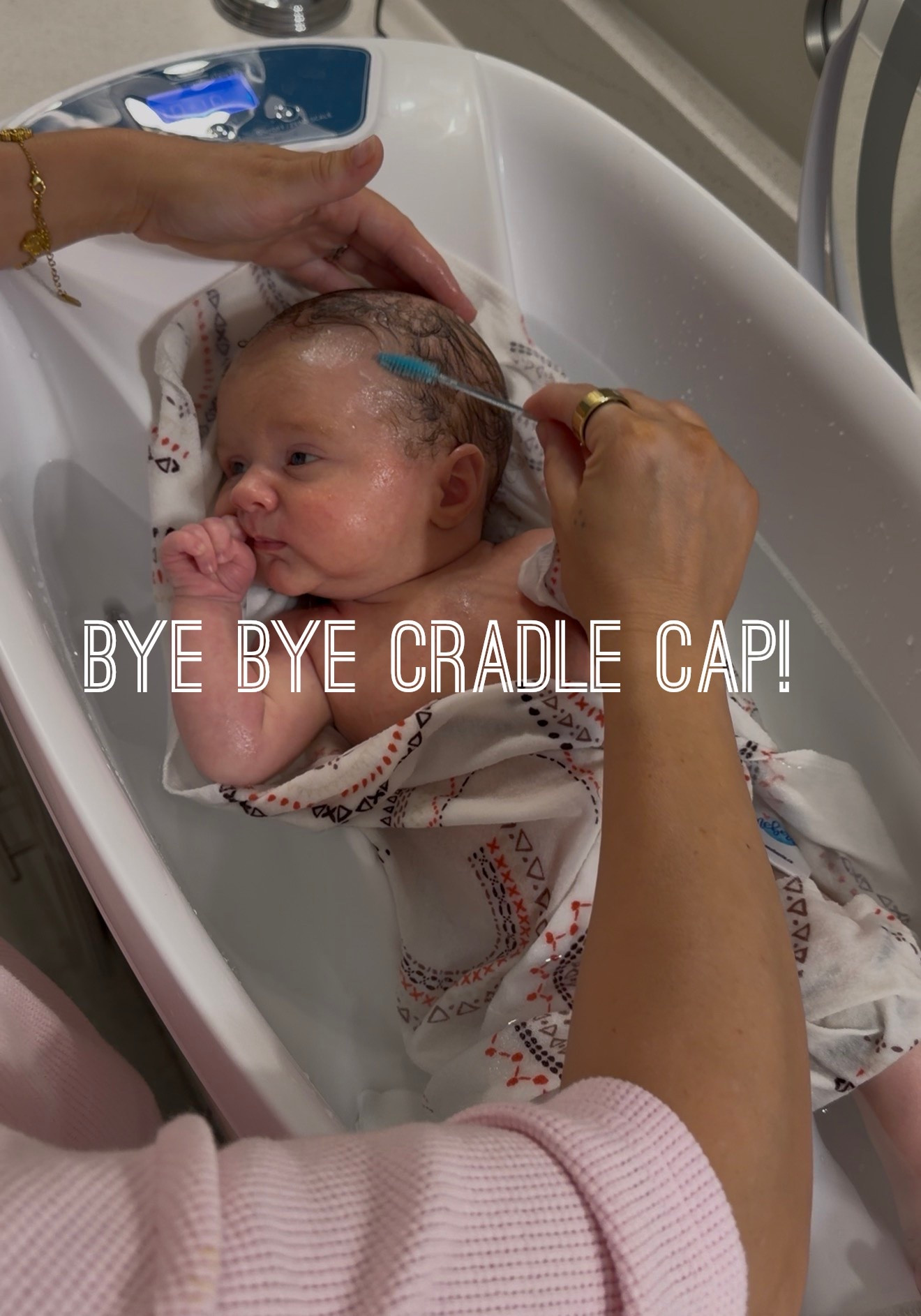 The best ways to remove baby cradle cap aka dead skin that builds up!

#LTKBaby #LTKBump