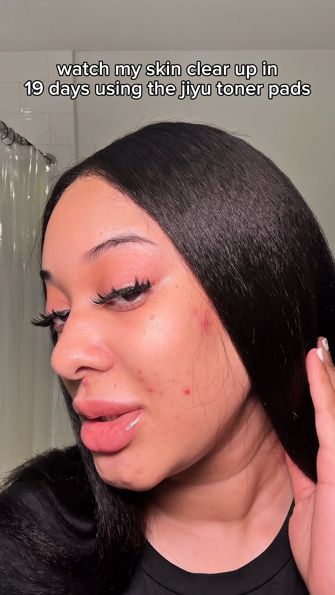 Watch my skin clear up in 19 days using these toner pads!

#LTKBeauty