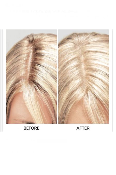 Root touch ups for blondes too!


#LTKStyleTip #LTKFindsUnder50 #LTKBeauty