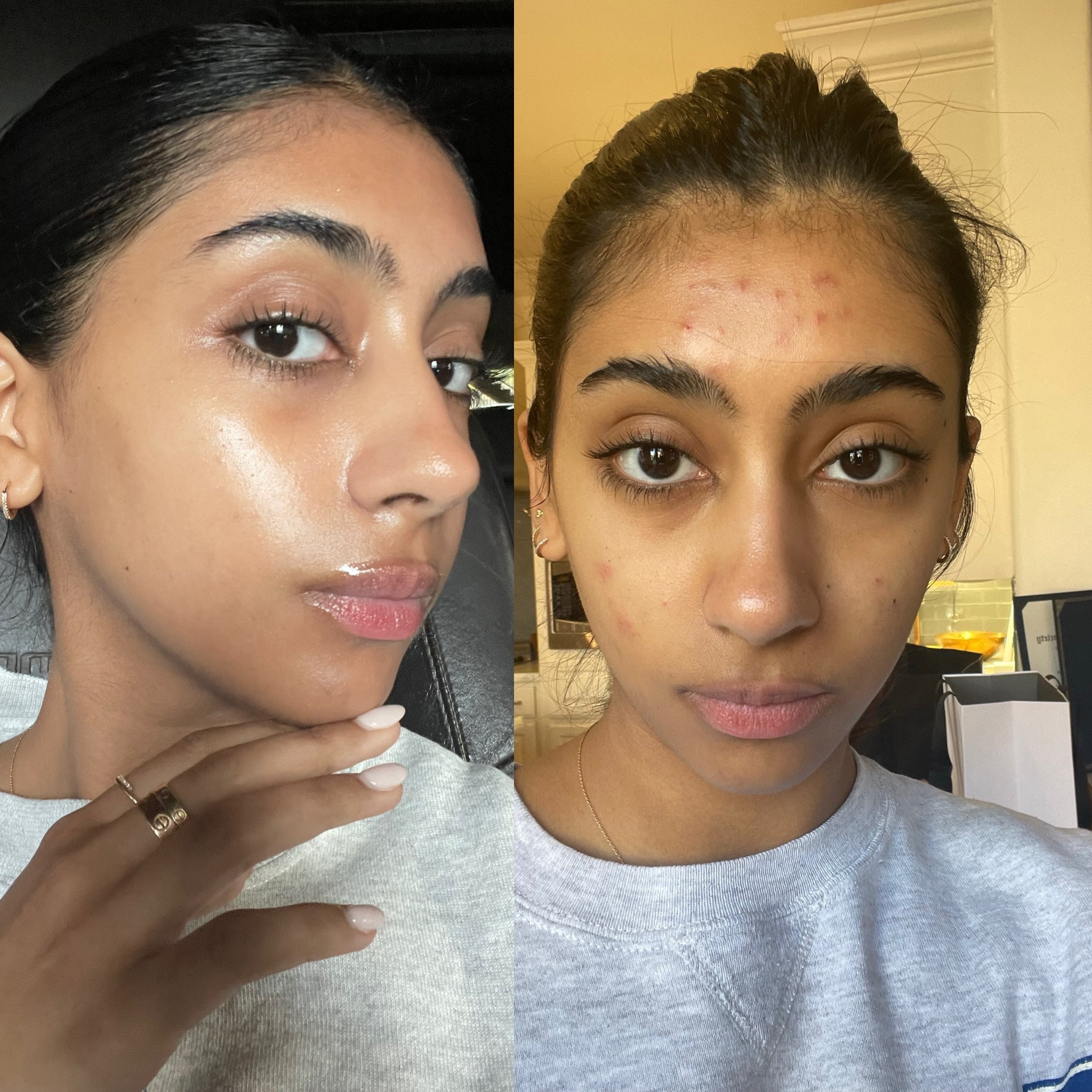 Products that changed my skin! 

#LTKFind #LTKbeauty #LTKstyletip