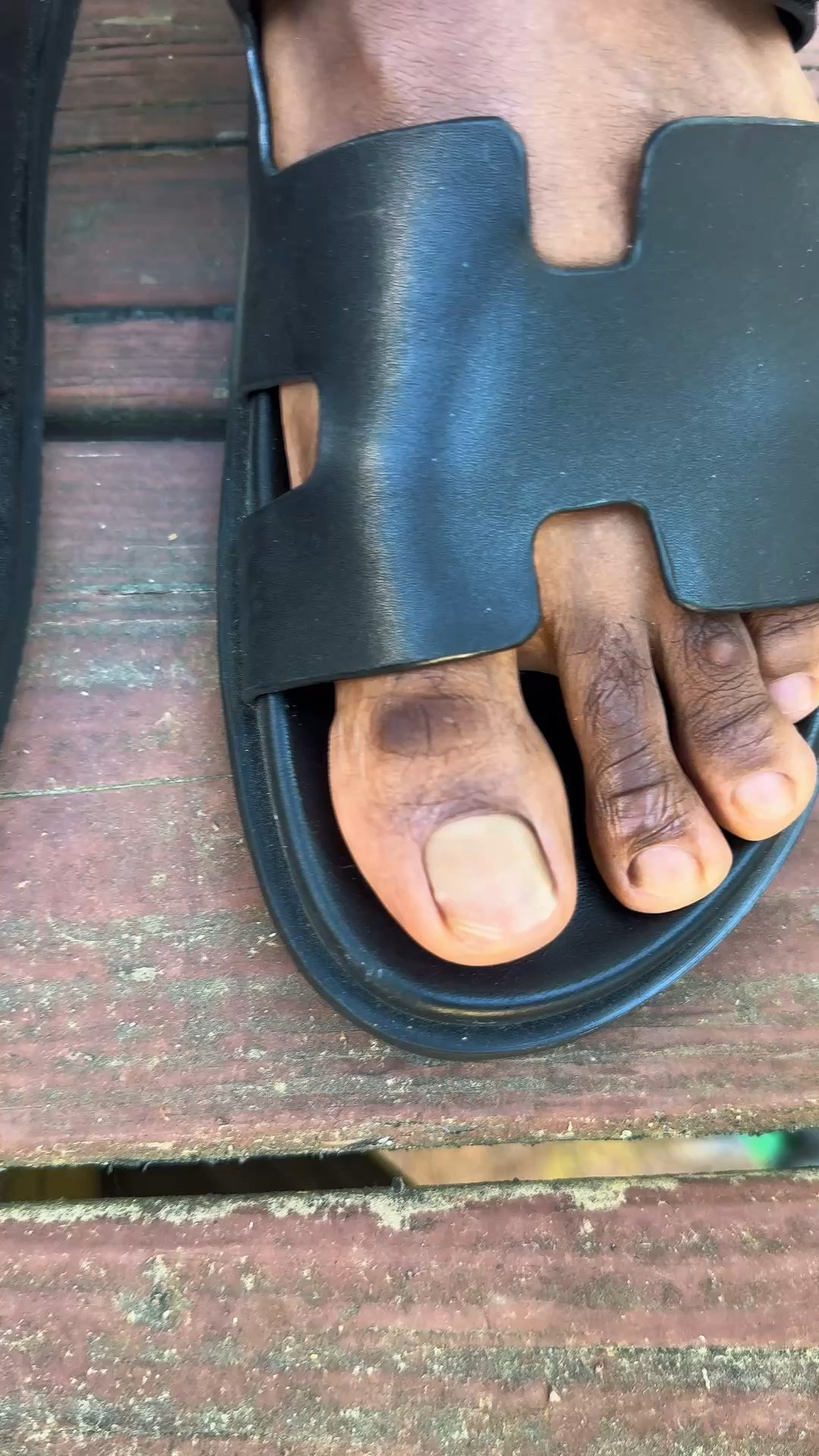 Dark toenails where 

#LTKselfcare