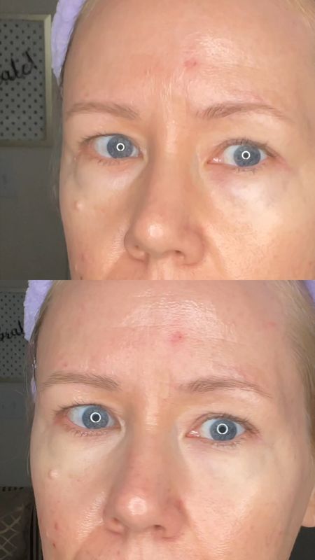 #giftedbyTheINKEYList 💫REAL 47 YEAR OLD SKIN- NO FILTER USED! This Caffeine eye cream ☕️ by @theinkeylist really helps with my swollen, puffy under-eyes! Look at the before/after! My new must-have! Did I mention that this is only $11? What?!? You need it!

#LTKover40 #LTKbeauty #LTKVideo