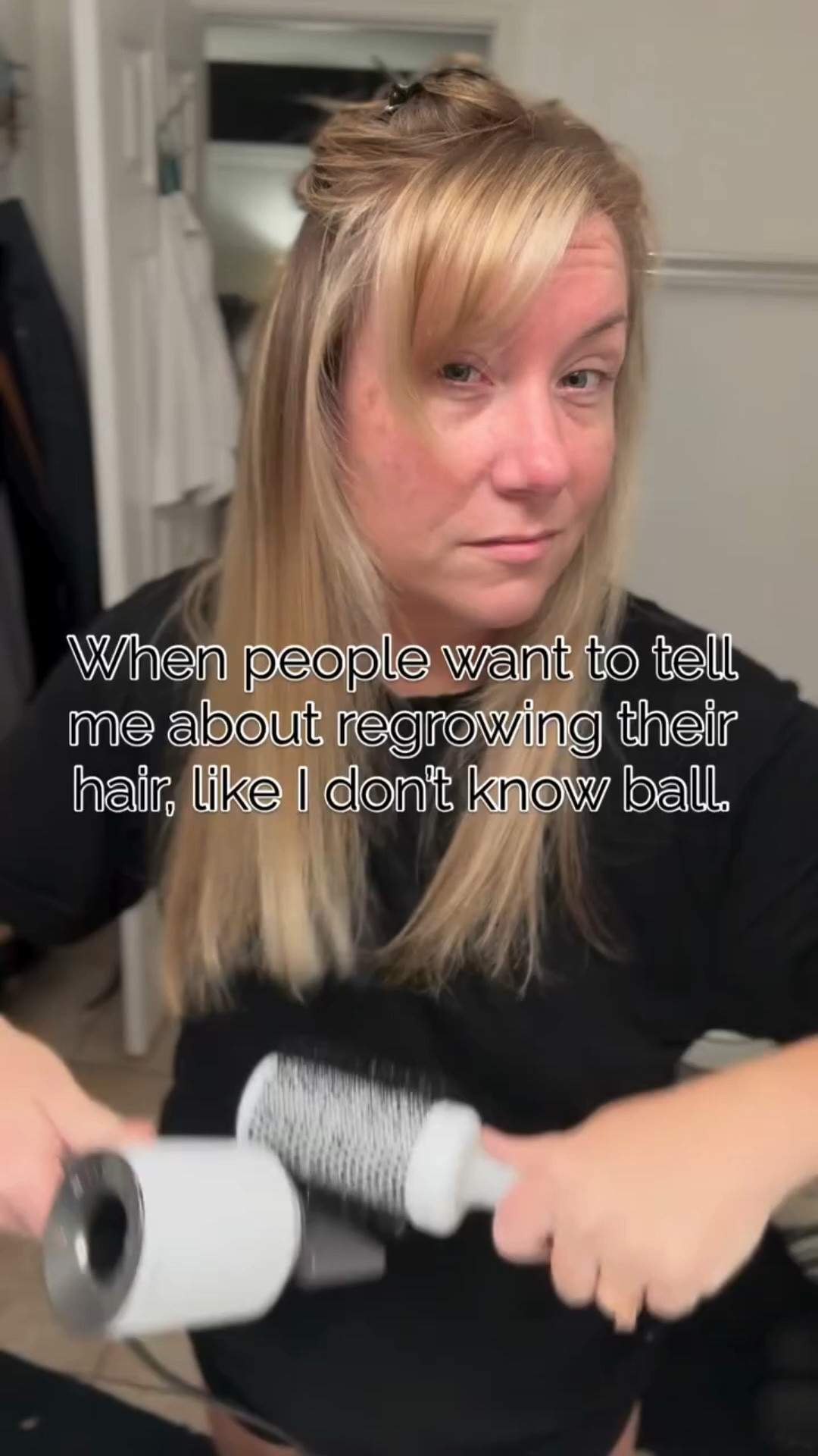 I have always had finer hair, but I had a ton of it on my head… until I didn’t. Thankfully I know how to style fine hair so you would never know…

But after losing almost 50 lbs, being on antibiotics for almost 6 months, then finally having surgery to rectify my issues… my hair started falling out in handfuls. 

As a hairstylist of 20+ years I went right to my trusty @nioxin shampoo, the new one that helps protect against hair fall is amazing! I paired it with the @diviofficial whipped mask as my conditioner each time I shampoo. I also use the Divi scalp serum and leave in conditioner… and look at that regrowth! All those shorter hairs you see are my hair growing back!

That’s why I am an ambassador for Divi… I haven’t made a single dime because I put it back into the products, because I love them that much! DM me for 🔗 if you’re interested, I also have 15% off for you!