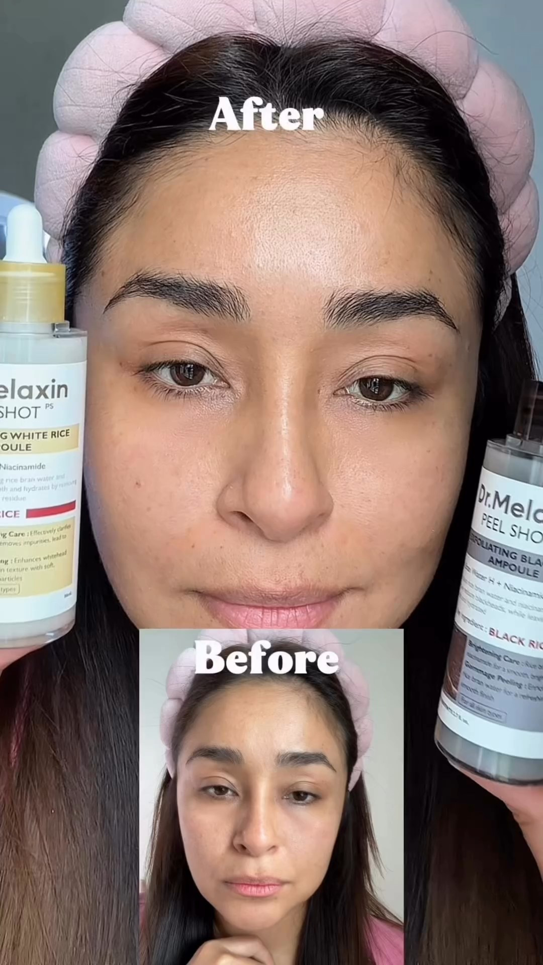 Probando  el dúo de ampollas de 
@dr.melaxin_global 
⚫️🌾 Peel shot exfoliant Black rice ampoule 
Es arroz negro para nutrición e hidratación.

⚪️🌾Peel shot exfoliant white rice ampoule 
y el otro lado con extracto de arroz para limpieza profunda y suavidad! 

✨✨El resultado
🤍piel fresca, luminosa y con ese
glow que tanto buscamos ✨🫶

#peelshot #drmelaxin
#drmelaxinpeelshot #kbeauty
#exfoliation