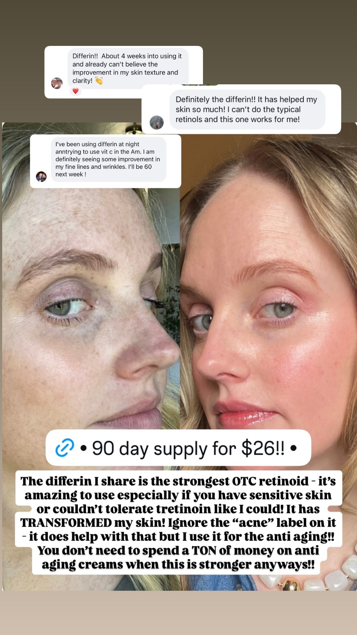 The differin I share is the strongest OTC retinoid - it’s amazing to use especially if you have sensitive skin or couldn’t tolerate tretinoin like I could! It has TRANSFORMED my skin! Ignore the “acne” label on it - it does help with that but I use it for the anti aging!! You don’t need to spend a TON of money on anti aging creams when this is stronger anyways!!

#LTKBeauty #LTKselfcare