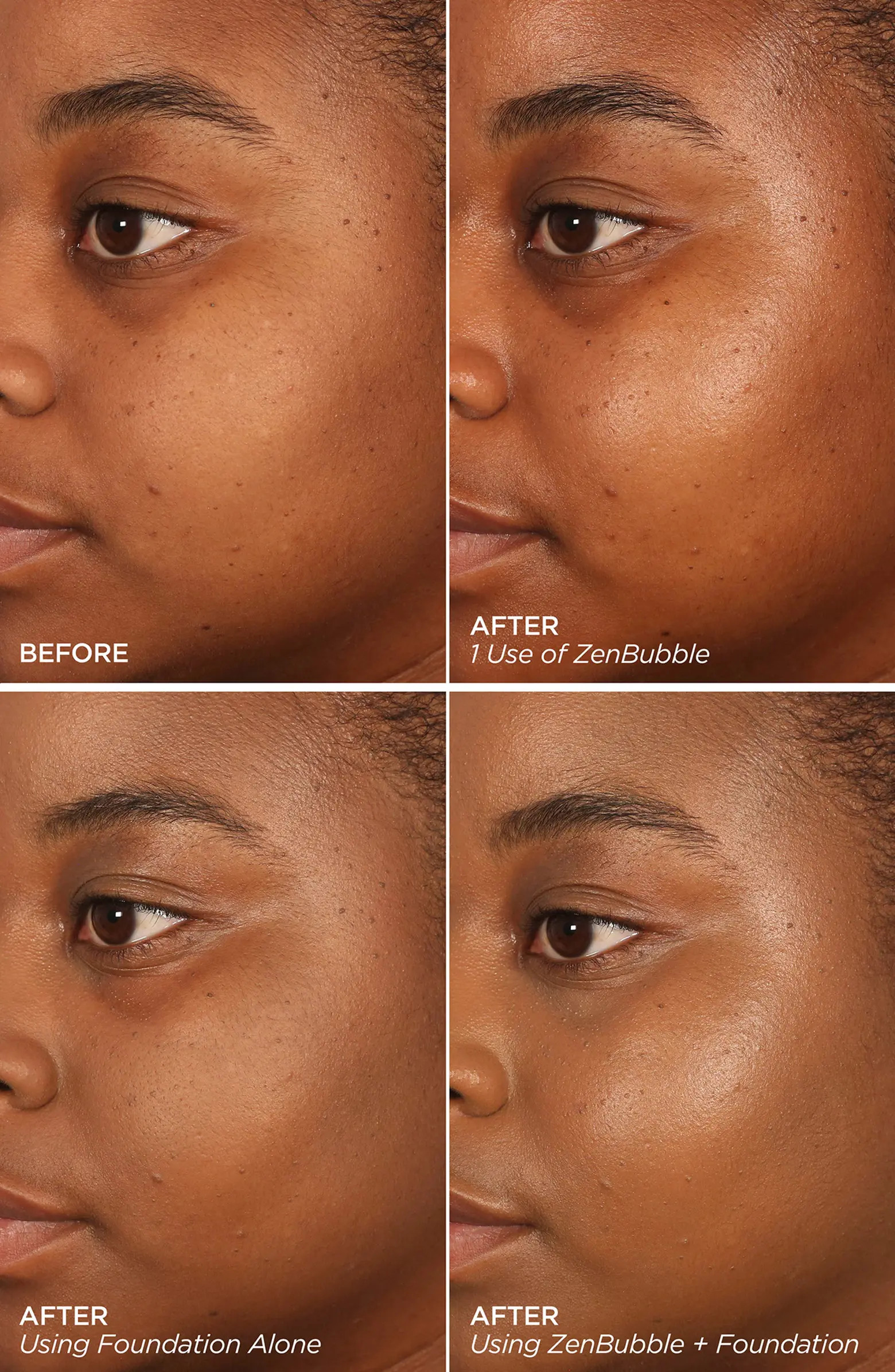 Instant Resurfacing & Clarifying Pore Detox Treatment Set $305 Value | Nordstrom