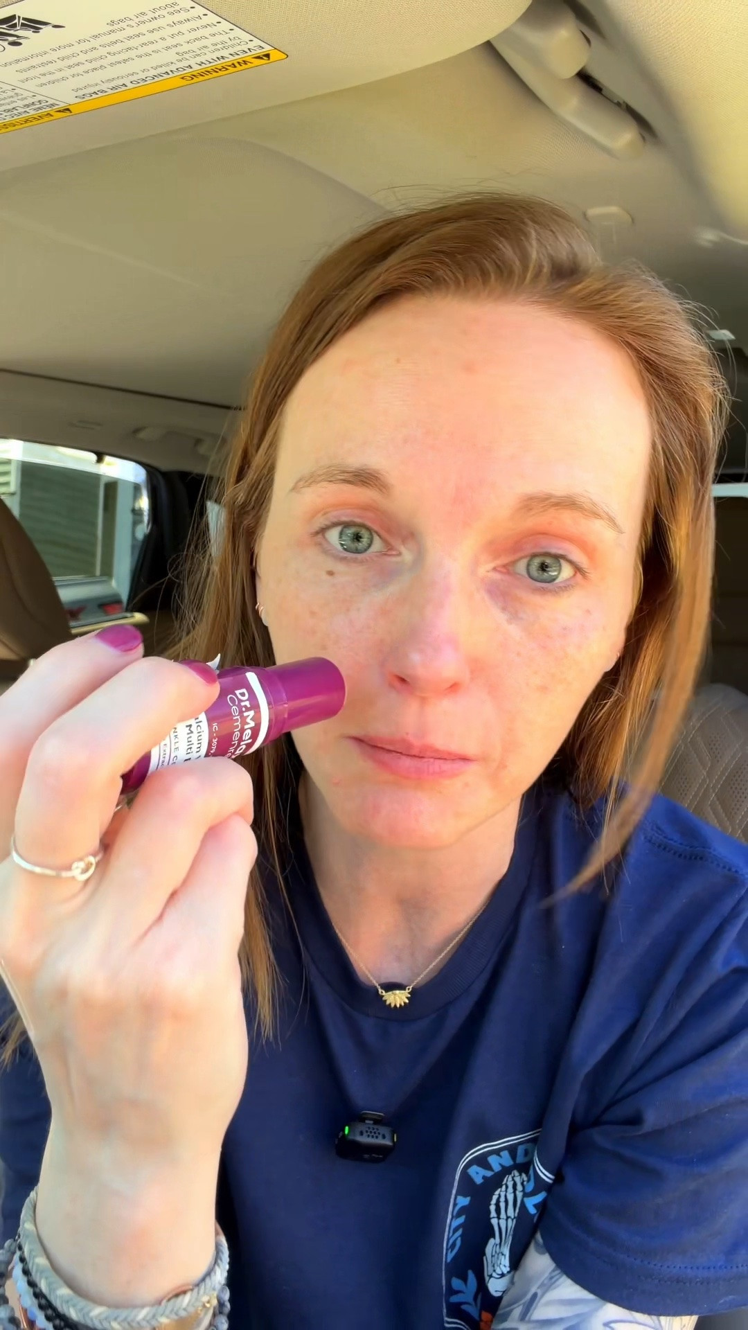 3-4 month review in Dr Melaxin multistick #drmelaxin #drmelaxinmultibalm #skincare#kbeauty #koreanskincare @drmelaxin

#LTKSaleAlert #LTKBeauty #LTKOver40