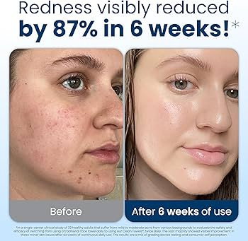 Clean Skin Club Clean Towels XL\u00ae, Travel Pack 100% USDA Biobased Disposable Face Towel, Ecze... | Amazon (US)