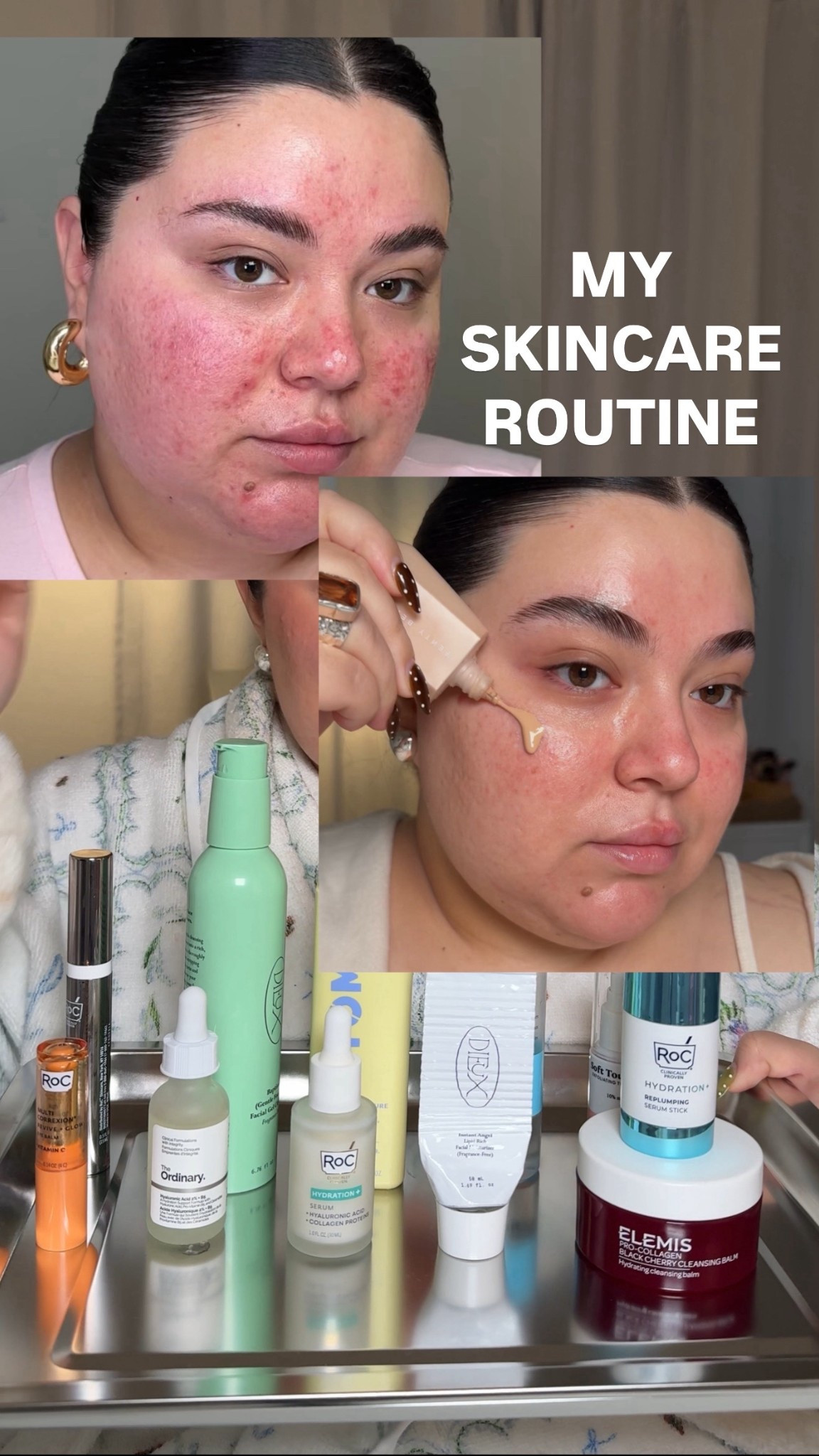 the skincare routine that healed me!! 

#LTKBeauty #LTKselfcare #LTKFindsUnder50