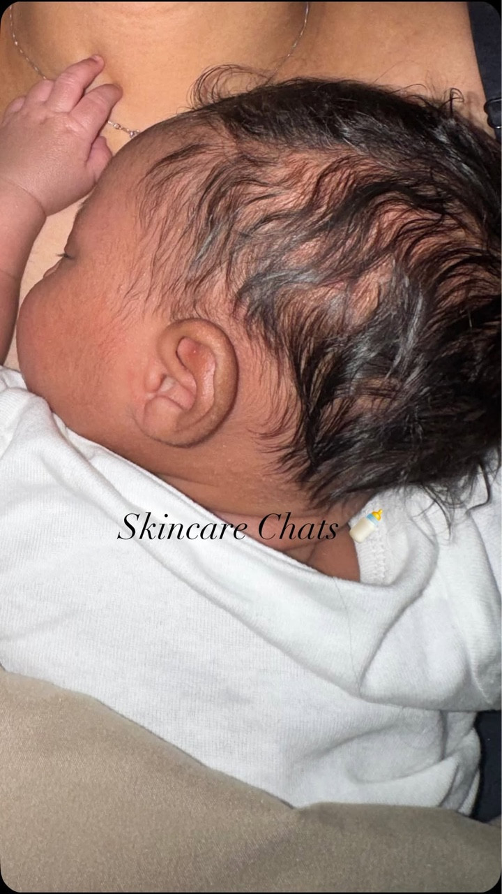 Skincare Chats | Q & A 🍼🧸

#LTKselfcare #LTKmomlife #LTKBeauty