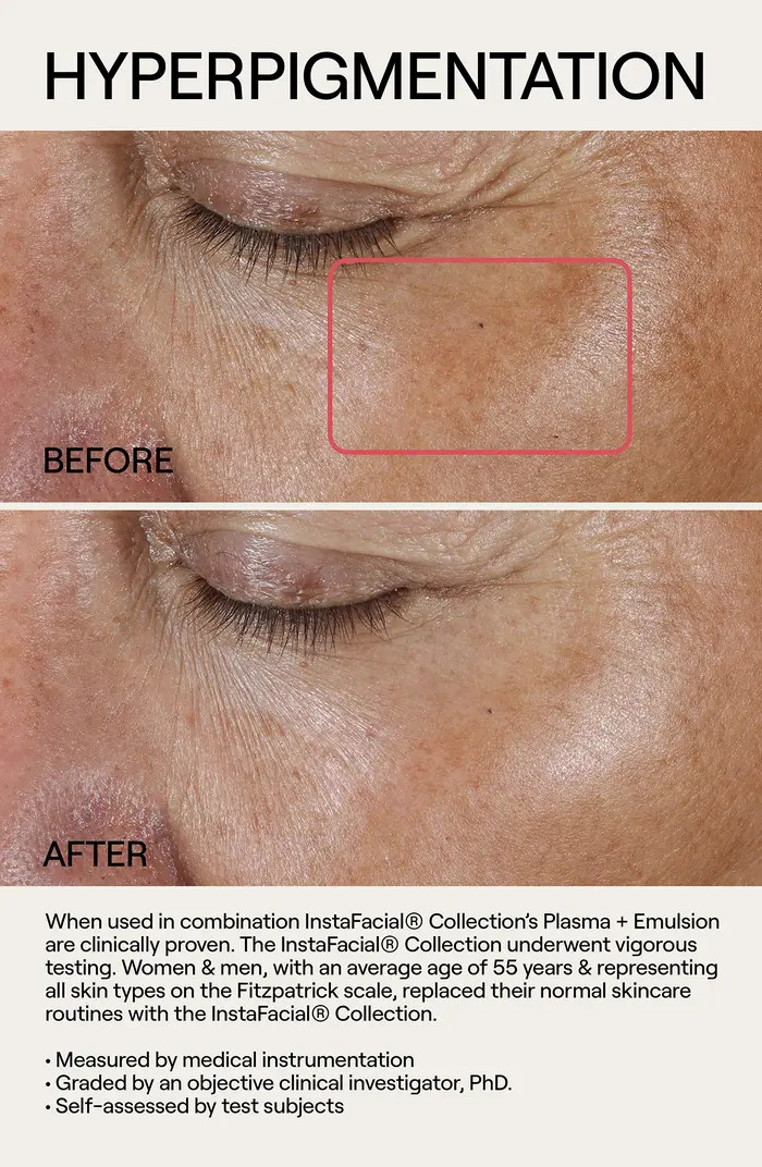 InstaFacial® Emulsion | Nordstrom