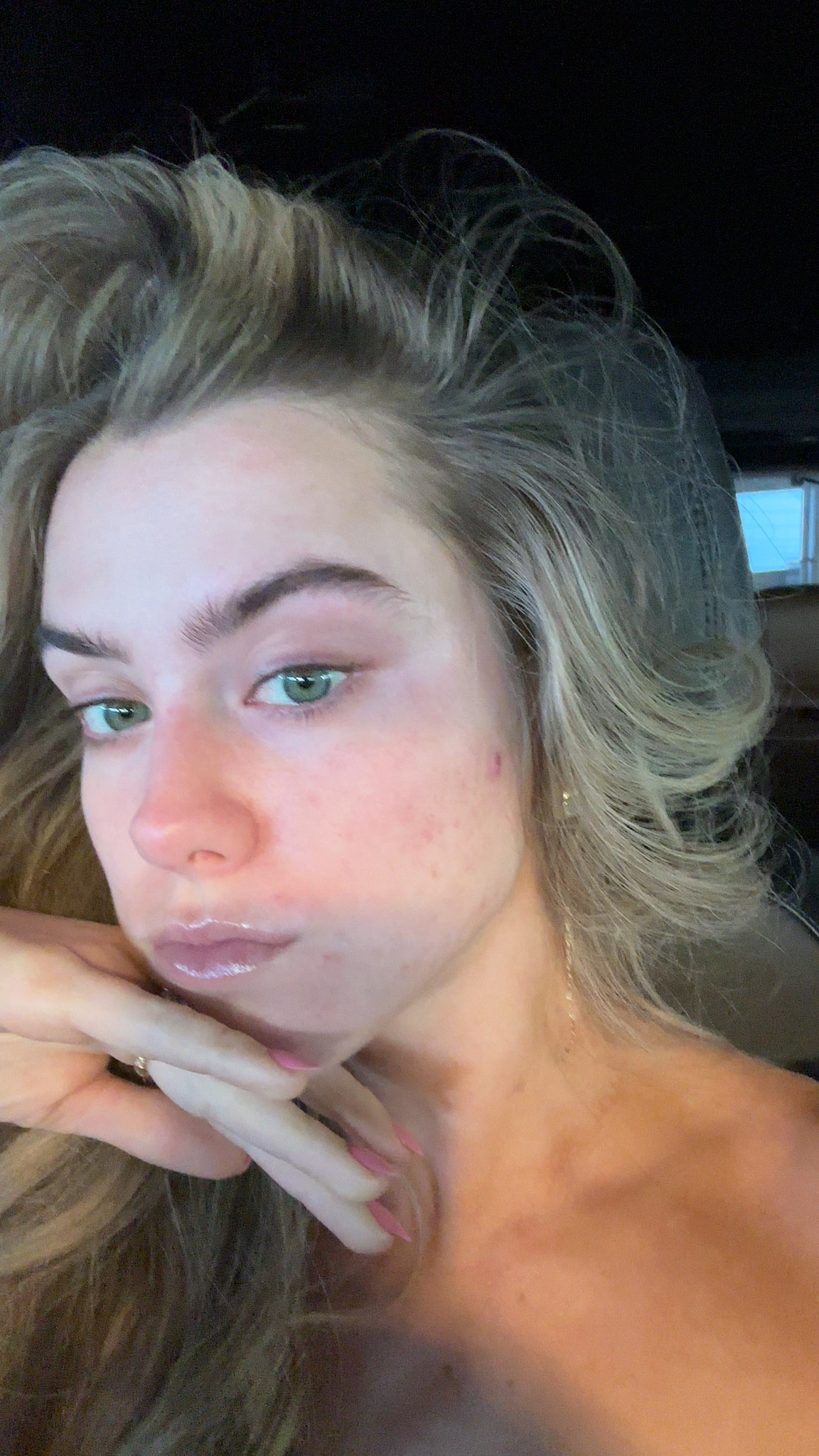 My skin is looking so good from all my treatments at Skin Pharm! 

#LTKselfcare #LTKBeauty #LTKgrwm