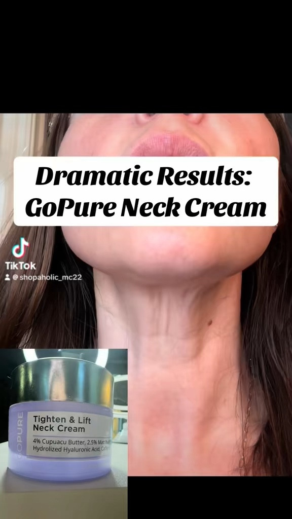 Don’t walk, RUN to get this product!  I am 43, I have lost over 60 pounds and my neck definitely told my story…that was until I found this amazing Tighten & Lift Neck Cream by @Gopure  The transformation speaks for itself!  #NeckTightening #SaggySkin #MatureSkin #Antiaging #NeckCream #SkinCare #AgingGracefully #MustHaveSkincare #FYP #ForYouPage #ForYou #ForYouOfficial