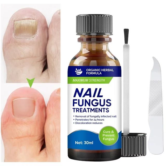 Toenail Fungus Treatment Extra Strength, Nail Fungus Treatment for Toenail & Fingernails, Nail Re... | Walmart (US)