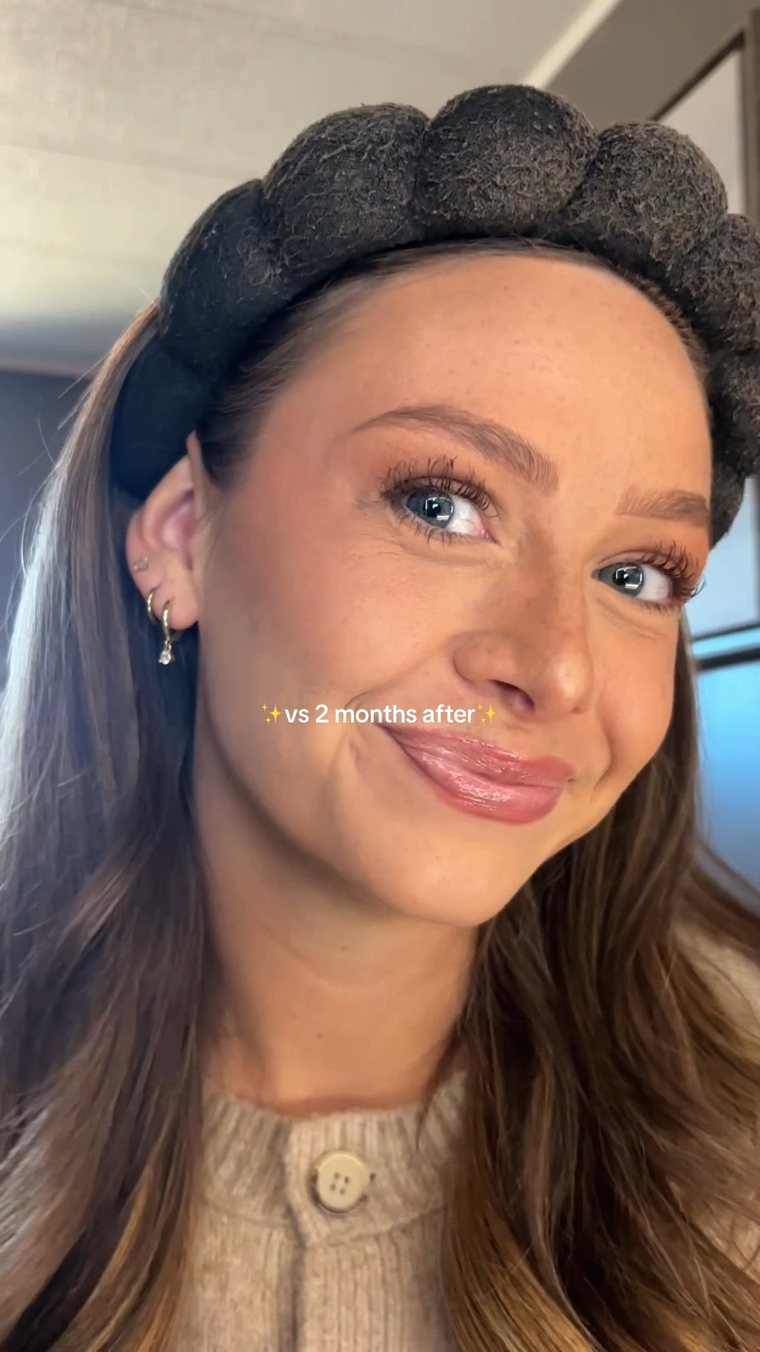 The ONLY lash serum that has given me results ✨ 

#LTKBeauty #LTKgrwm #LTKselfcare