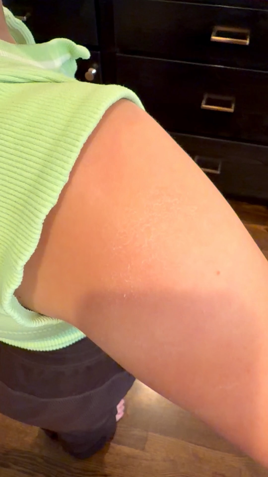 The best balm for dry patches, elbows and more!

#LTKmomlife #LTKdayinmylife #LTKmorningroutine