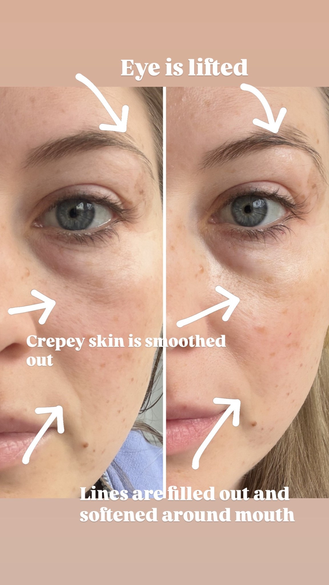 I’ve been using Aquaphor in my skincare routine lately and it has made such a difference. It keeps my skin feeling so hydrated and smooth, and gives that dewy, healthy glow.

aquaphor skincare, aquaphor healing balm, skin hydration routine, dry skin remedy, glowing skin routine, skin barrier repair, everyday skincare essential, hydrating face balm, dewy skin look, simple skincare routine, SavannahK

#LTKBeauty #LTKmomlife #LTKselfcare