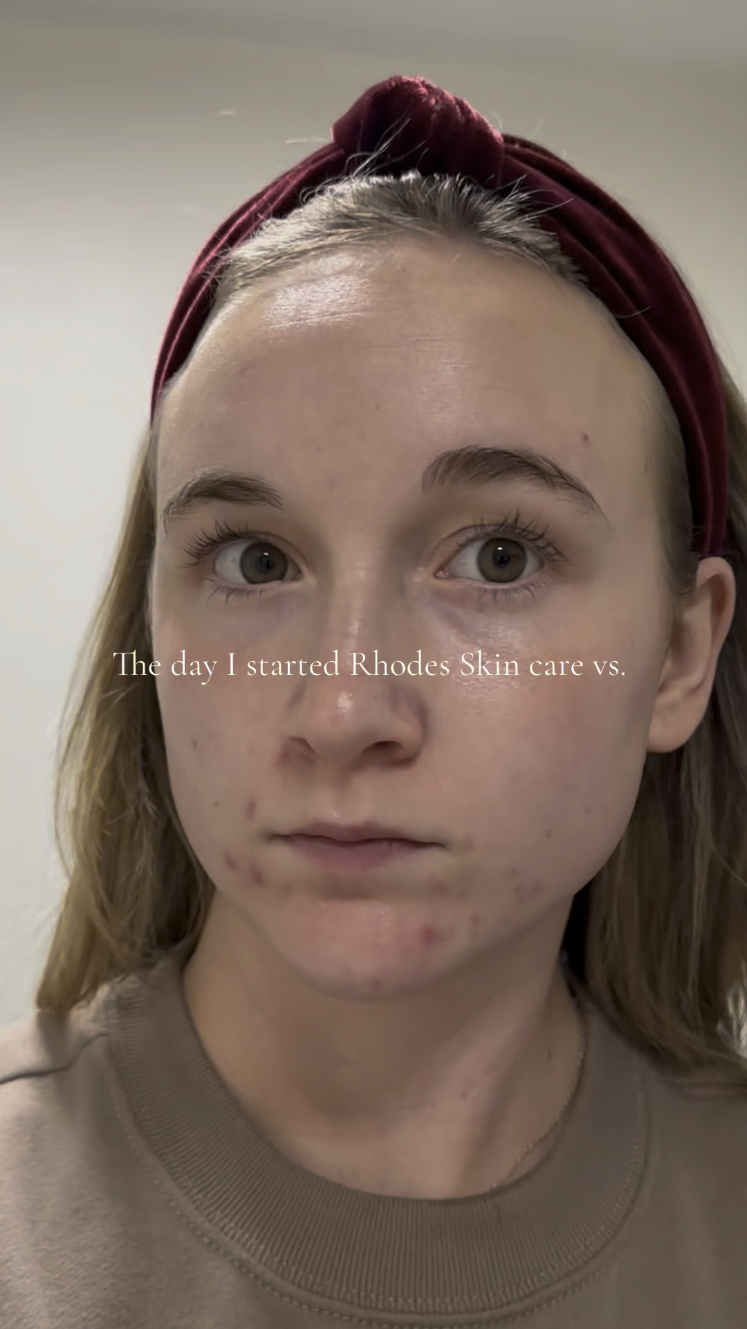 Rhodes skincare and supplements 

#LTKBeauty #LTKFindsUnder100 #LTKGiftGuide