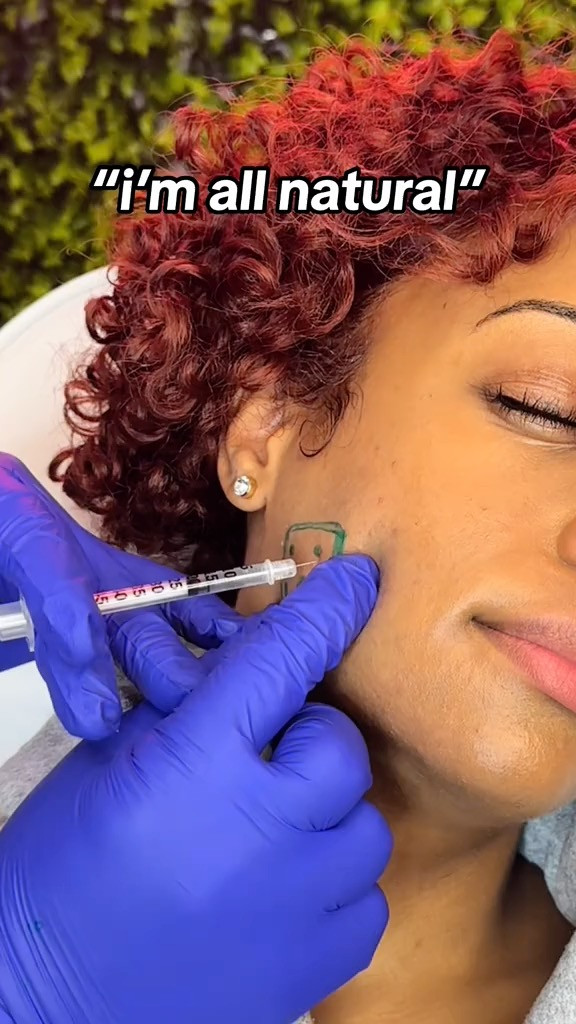 one thing about me, im gonna spend $$$ on some treatments🫣 locations:

INJECTIONS:📍Made by Megan in White Plains
LASER: 📍Najia’s Skin & Laser in Mamaroneck

#blackgirltiktok  #chemicalpeel  #laserhairremoval  #botox 

 