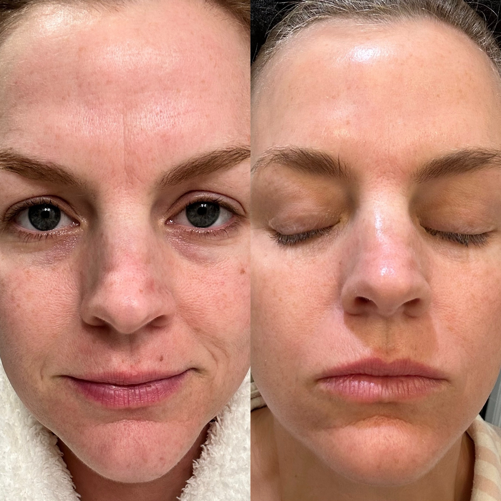 The only thing I’ve been consistent about for my skincare are these 3 products. Obagi Tretinion is a prescription or sold at derm offices (I believe) 

#LTKBeauty