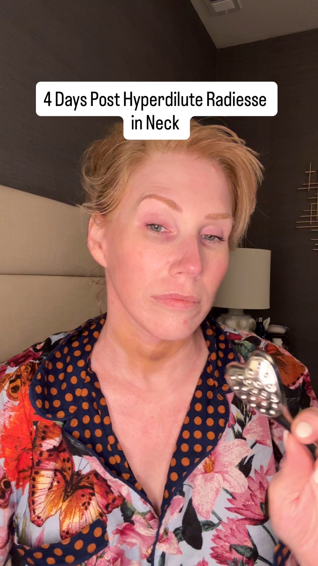 Massaging away after my Hyperdilute Radiesse treatment to prevent nodules! #neckskin #over40beauty #radiesse

#LTKOver40 #LTKselfcare #LTKBeauty