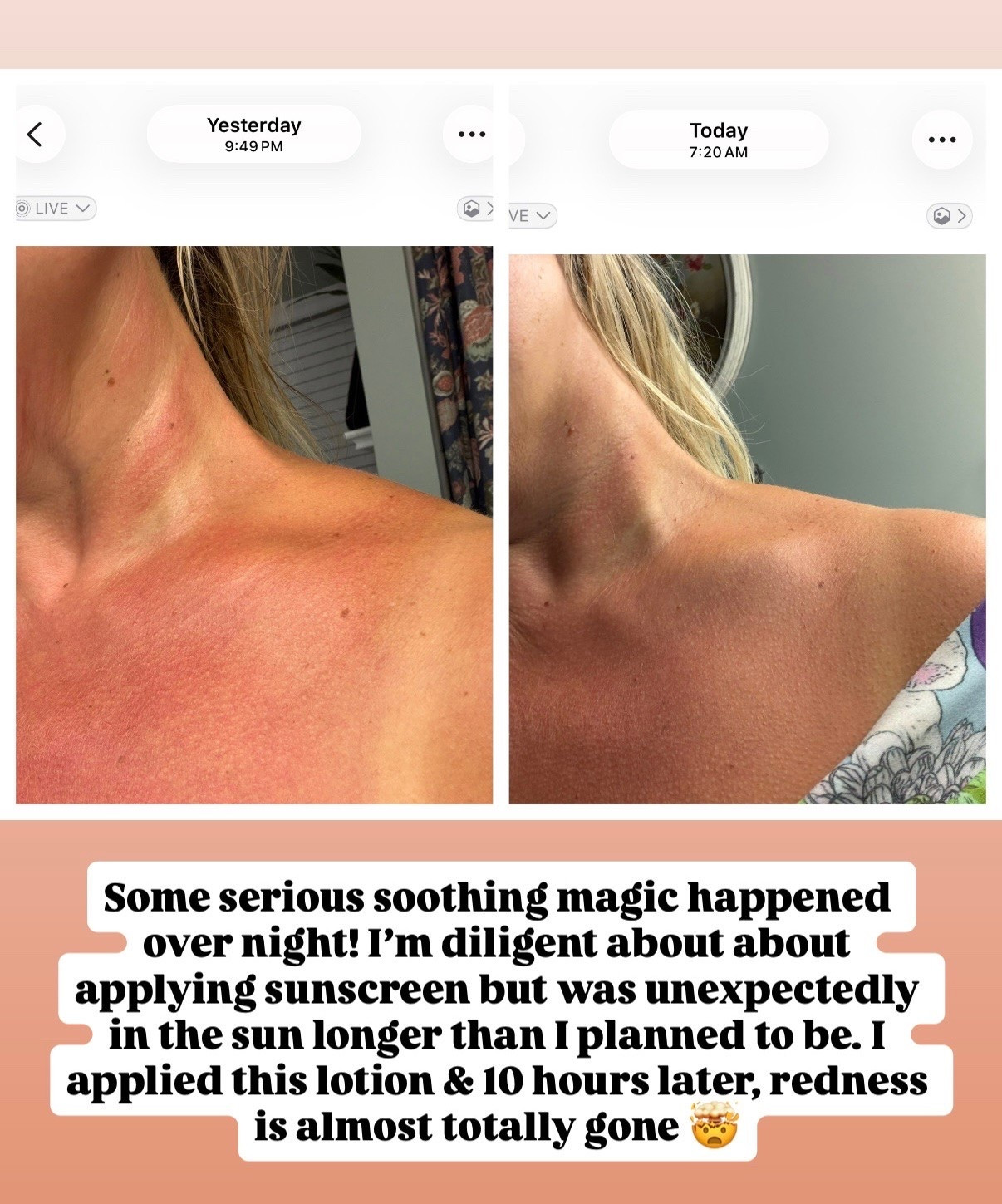 Sunburn soothing lotion! I used the cream version but I’ve heard the spray is equally as amazing so I added it to my cart immediately!!

#LTKOver40 #LTKSeasonal