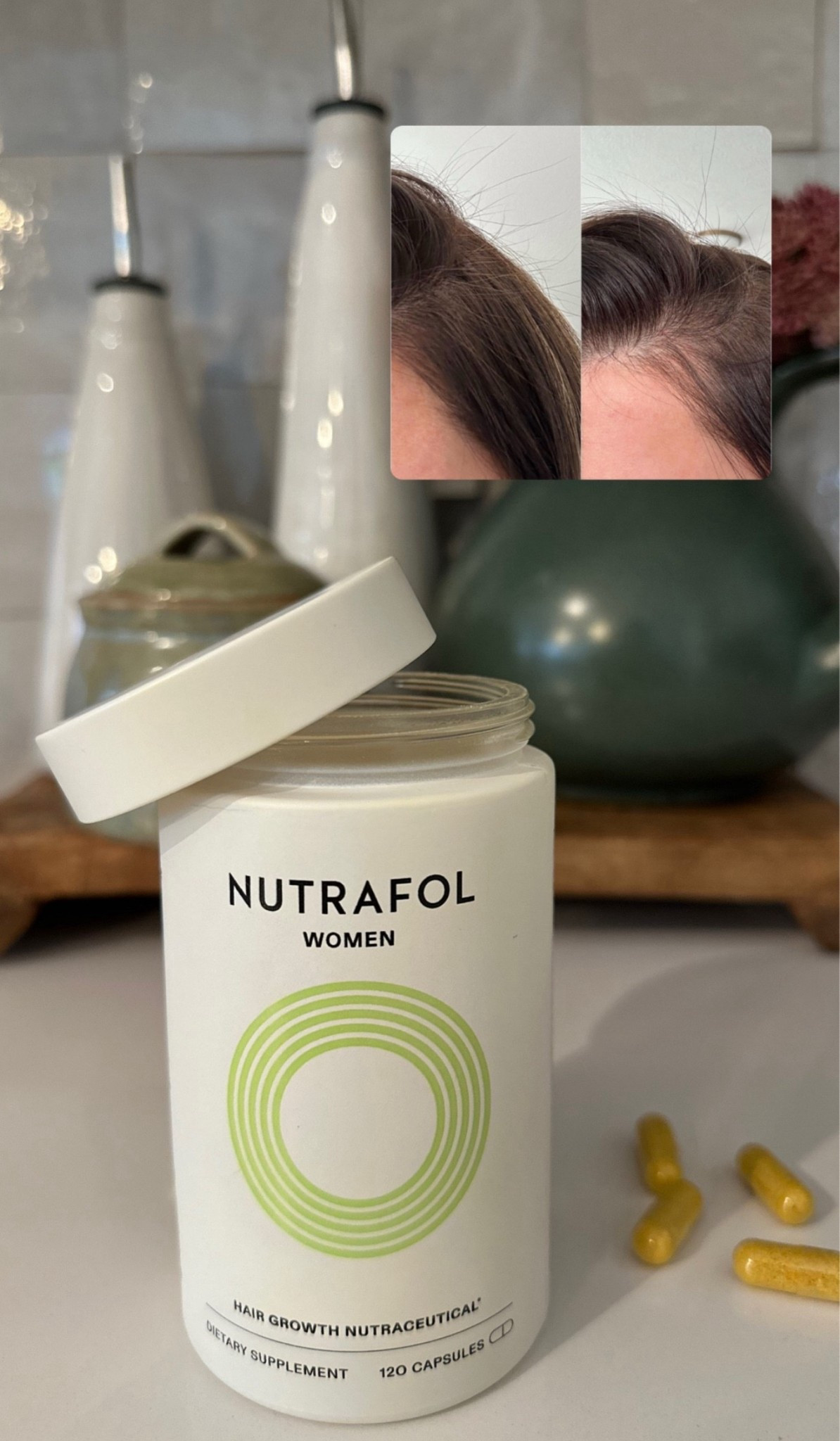 Nutrafol Discount!! 

#LTKBeauty #LTKGiftGuide #LTKselfcare