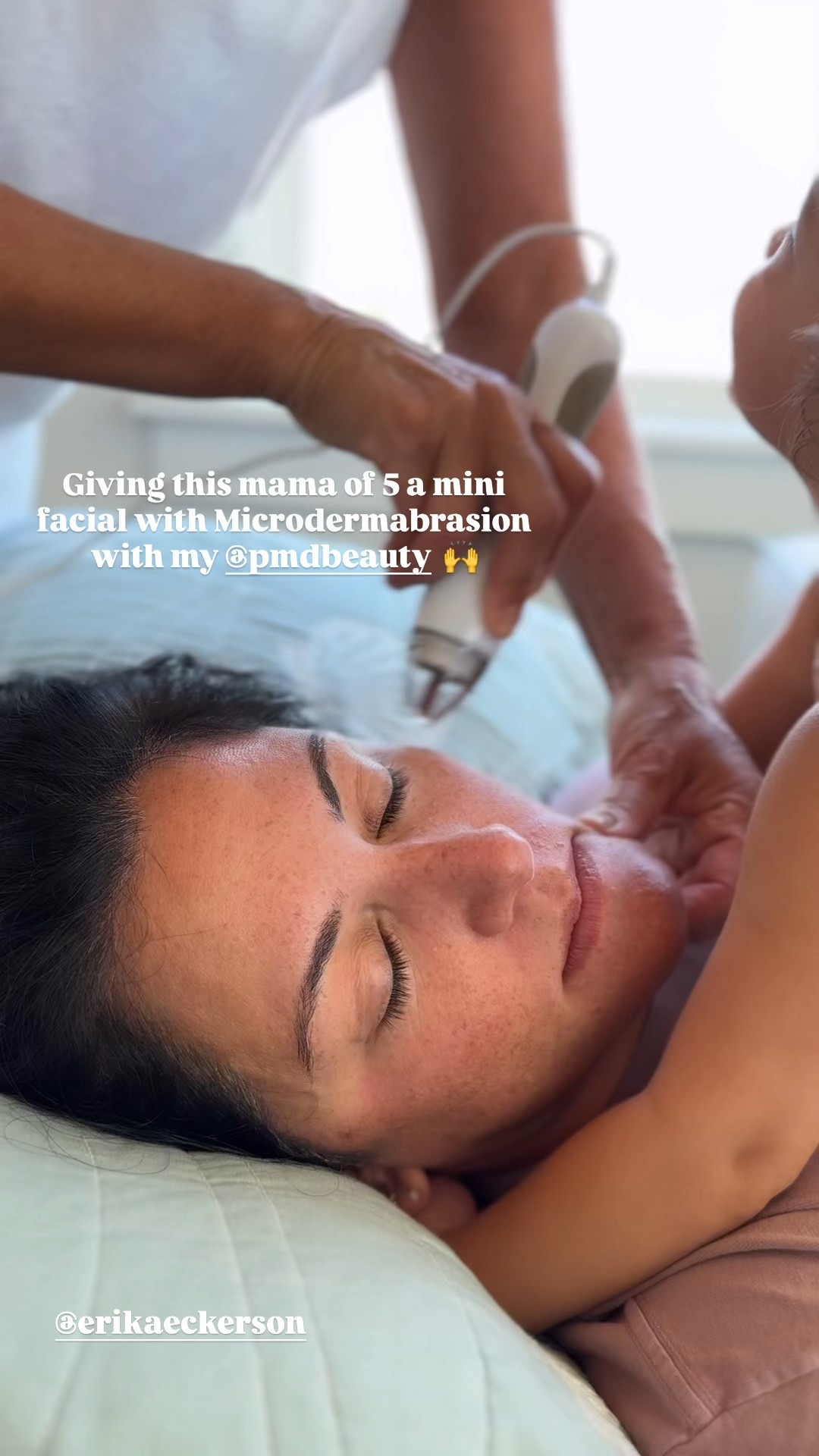 Microdermabrasion on the Nsale 
By @pmd 

#LTKOver40 #LTKSaleAlert #LTKBeauty