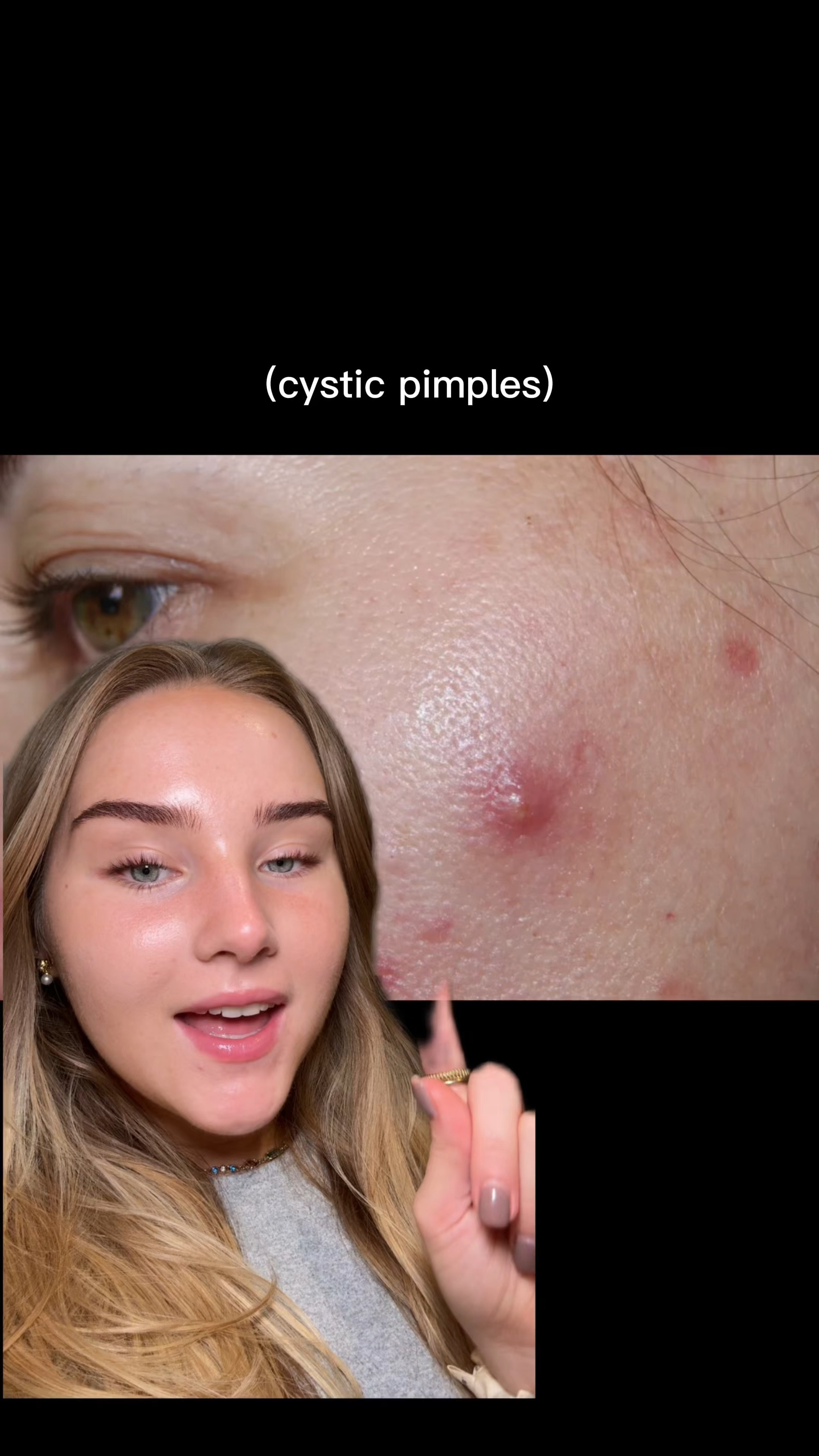 Skincare Recommendations⭐️⬇️

products mentioned:
⭐️Cystic Pimples: @medicube_global_official red succinic acid peeling pad
⭐️Closed Comedones: @celimax.global BHA peeling pad
⭐️Blackheads: @ilso_official natural mild clear nose patch
⭐️Broken Skin Barrier: @purito_official mighty bamboo panthenol cream
⭐️Clogged/Textured Skin: @mixsoon_official bean essence
⭐️Post Acne Marks: @haruharuwonder_official centella 4% TXA dark spot go away serum

•

#skincarerecommendations #skincare #acne #acneproneskin #skintok #koreanskincare 