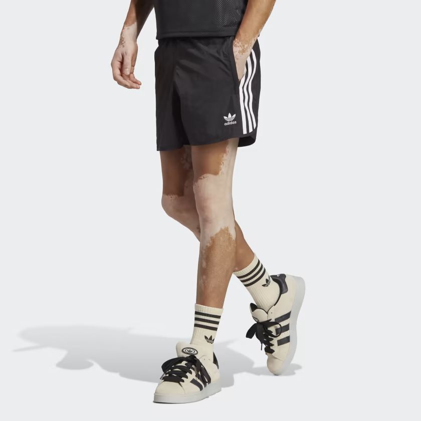 Adicolor Classics Sprinter Shorts | adidas (US)