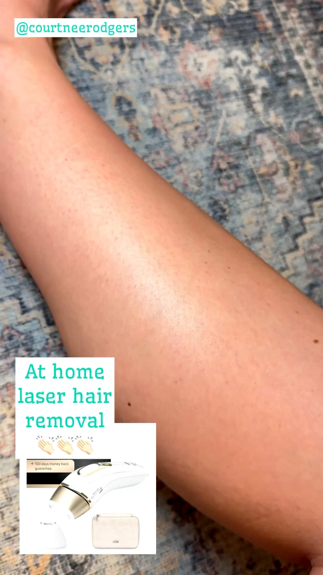 At home laser hair removal ☀️ 

Got this at home laser hair removal for Christmas! I’ve used it 5 times since January (once a week) Pain is completely bearable in ALL areas! 😉 —this thing WORKS!!!

Hair removal, beauty, Amazon beauty, laser hair removal 

#LTKdayinmylife #LTKootd #LTKSwim
